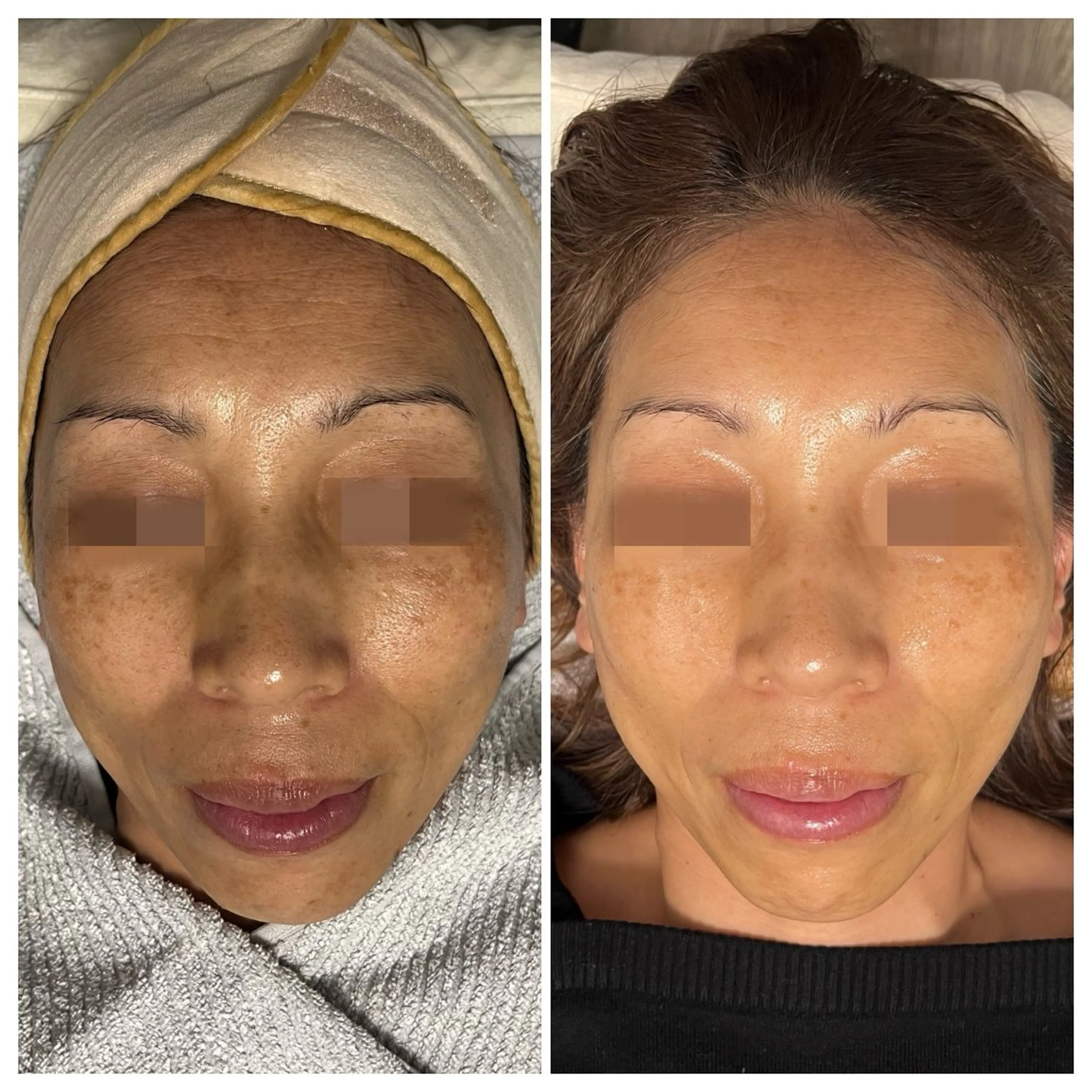 エステ 成宮鍼灸整骨院 & total  beauty  salon所属・中村 優美のエステ・リラクイメージ