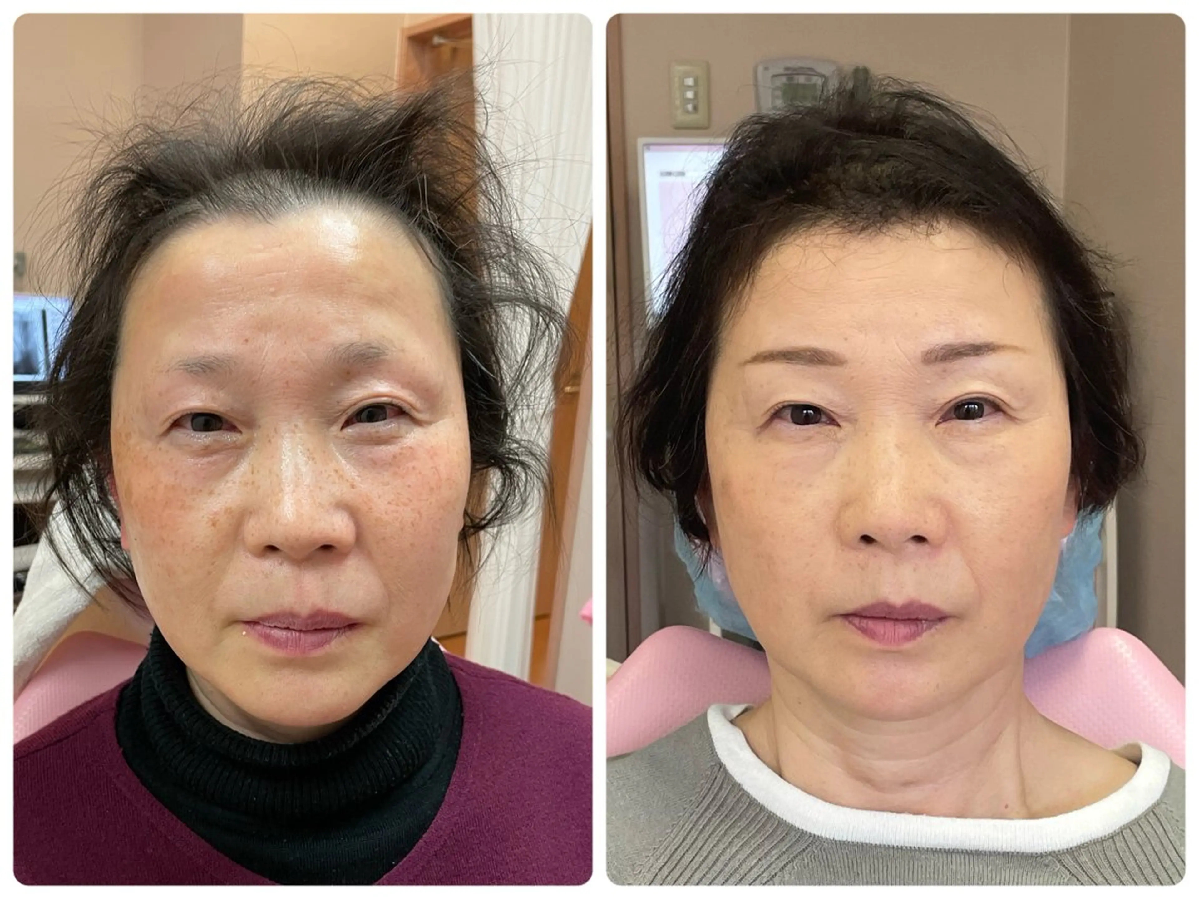 Salon Rion所属・Rion 野々村のエステ・リラクイメージ