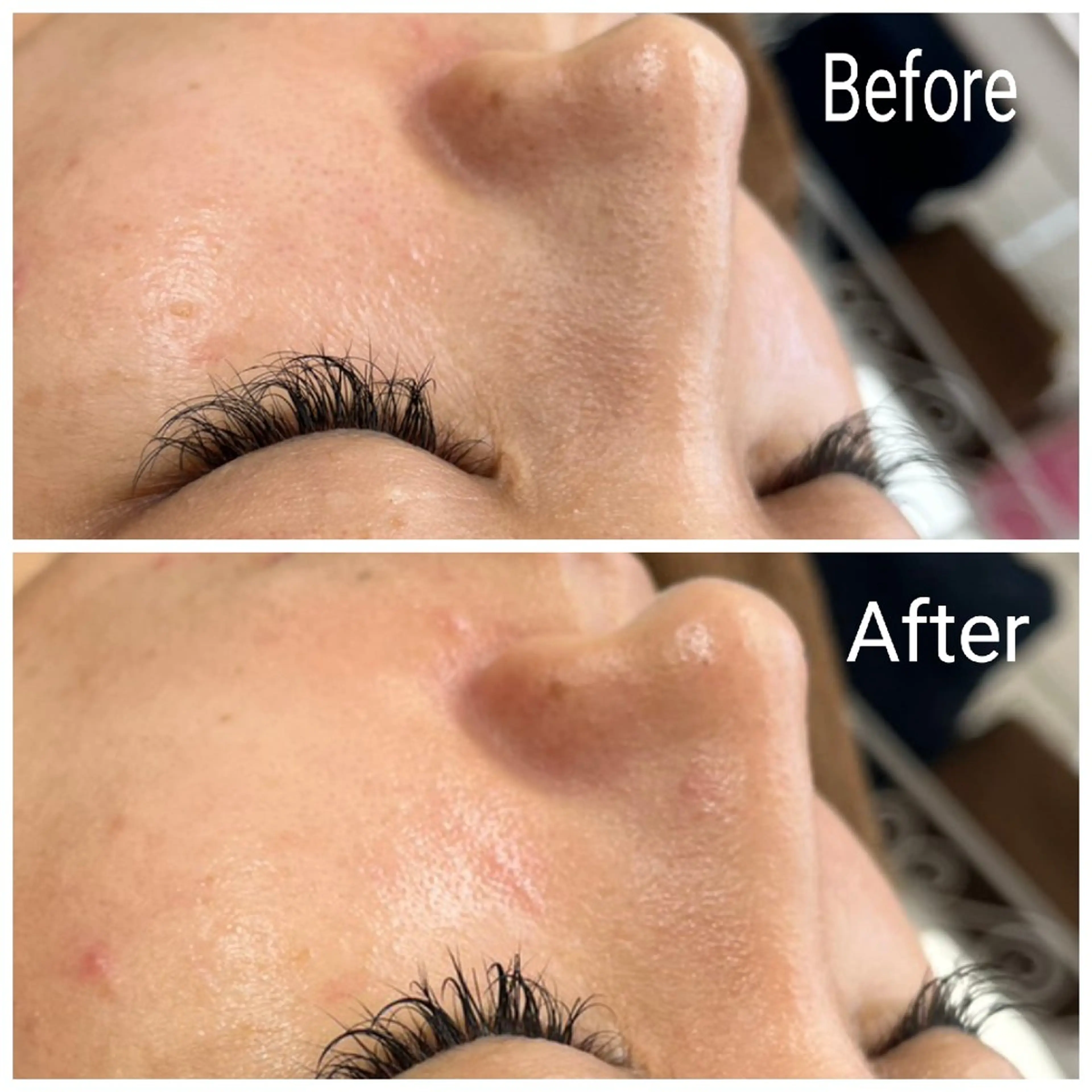 エステ リラク 肌質改善Beauty salon Renのエステ・リラクイメージ