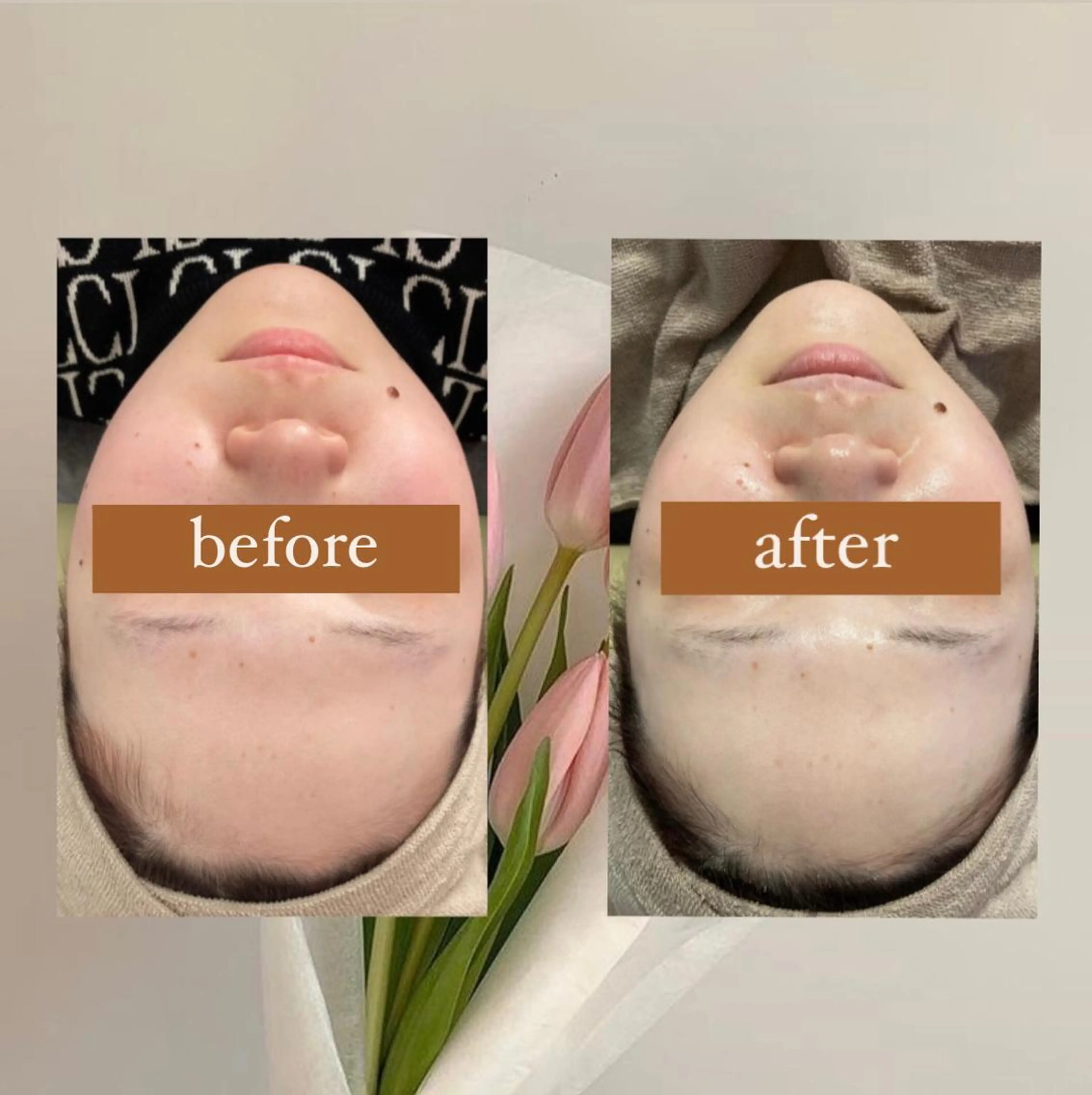 エステ crescent所属・【韓国肌管理・脱毛】 クレセントのその他イメージ