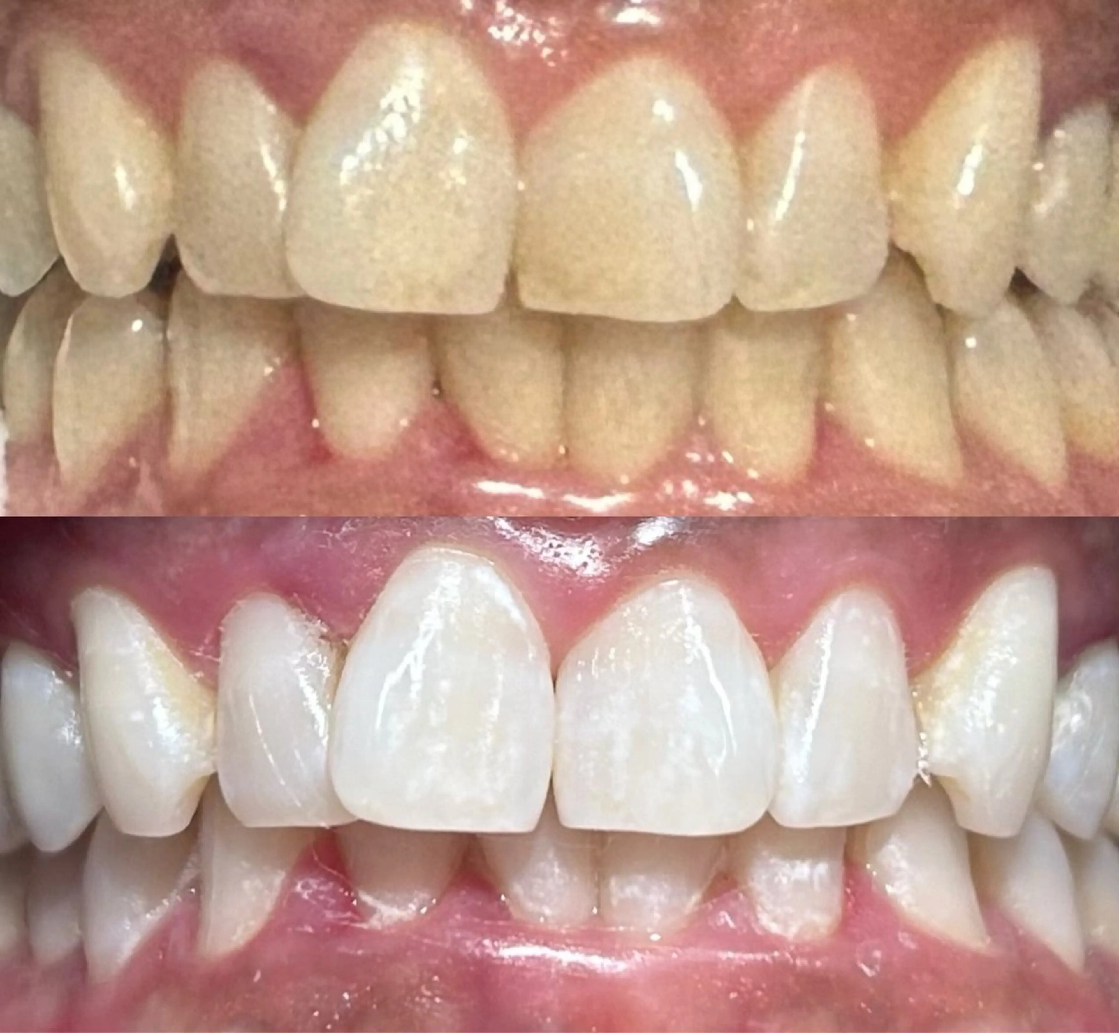 io teeth careのその他イメージ