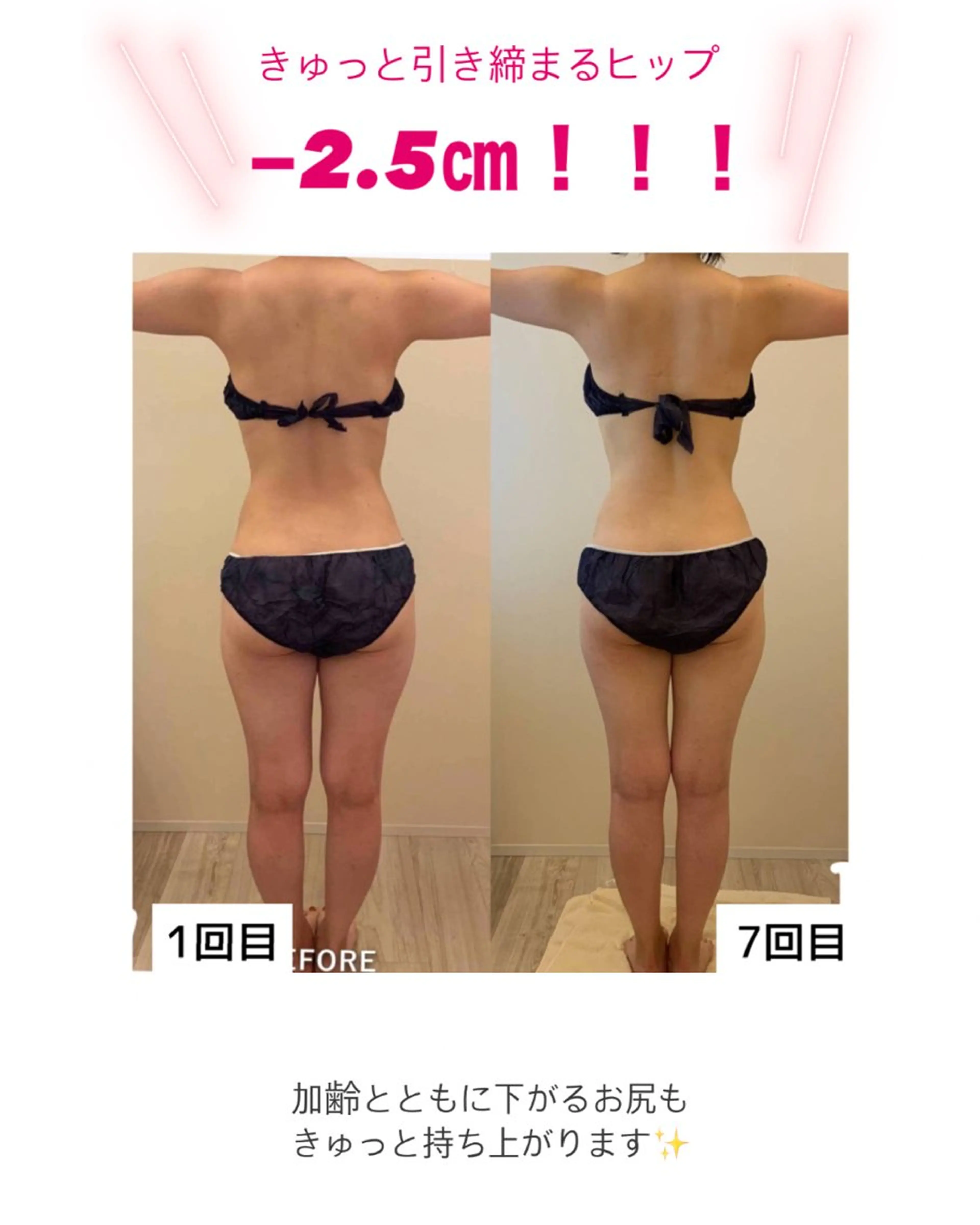 産後ダイエット−9㎏ Pourvous結衣のエステ・リラクイメージ