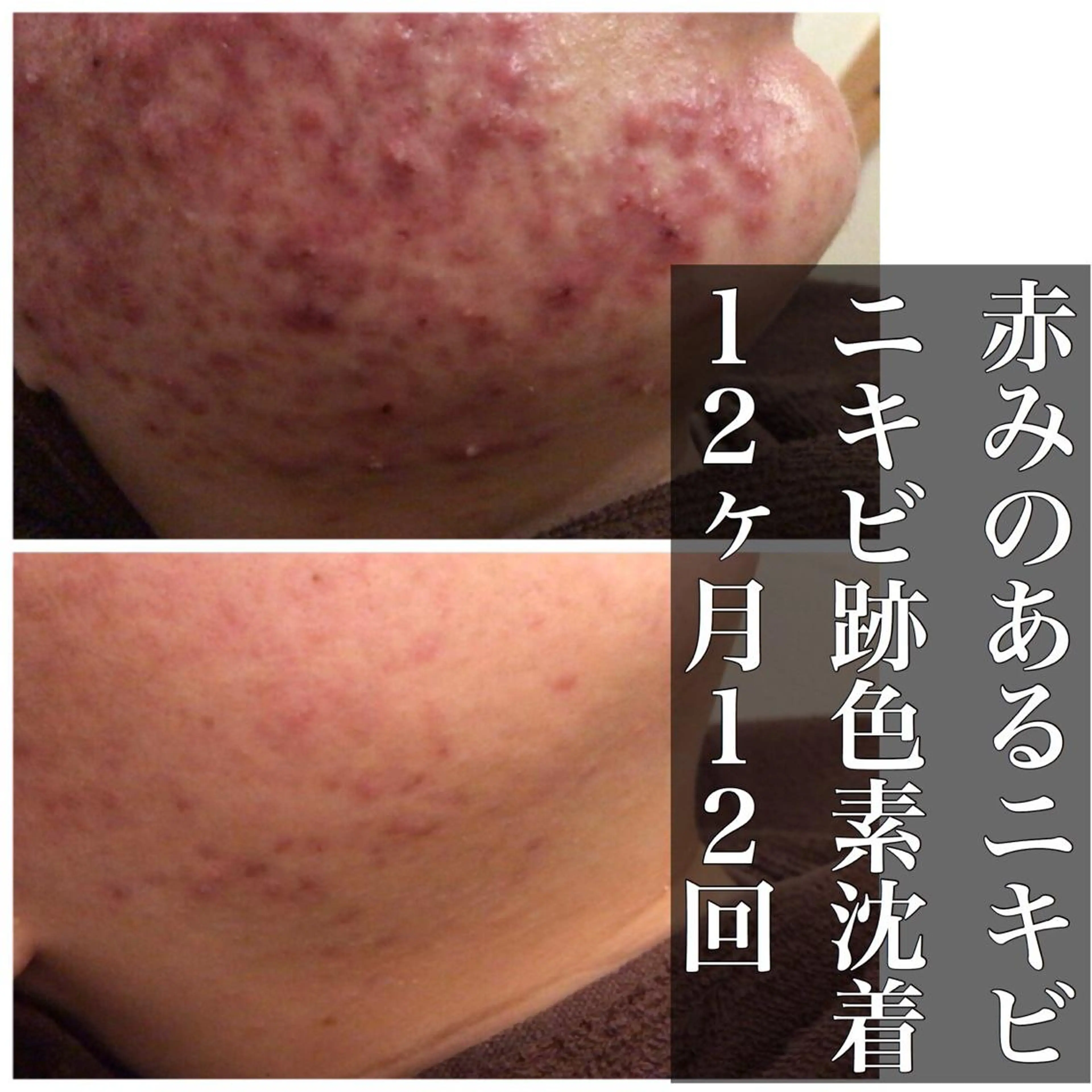 ミディアム カラー パーマ ヘアアレンジ メンズ キッズ ネイル マツエク・マツパ エステ リラク ニキビ・肌質改善専門 ♡人生が変わるサロンのエステ・リラクイメージ