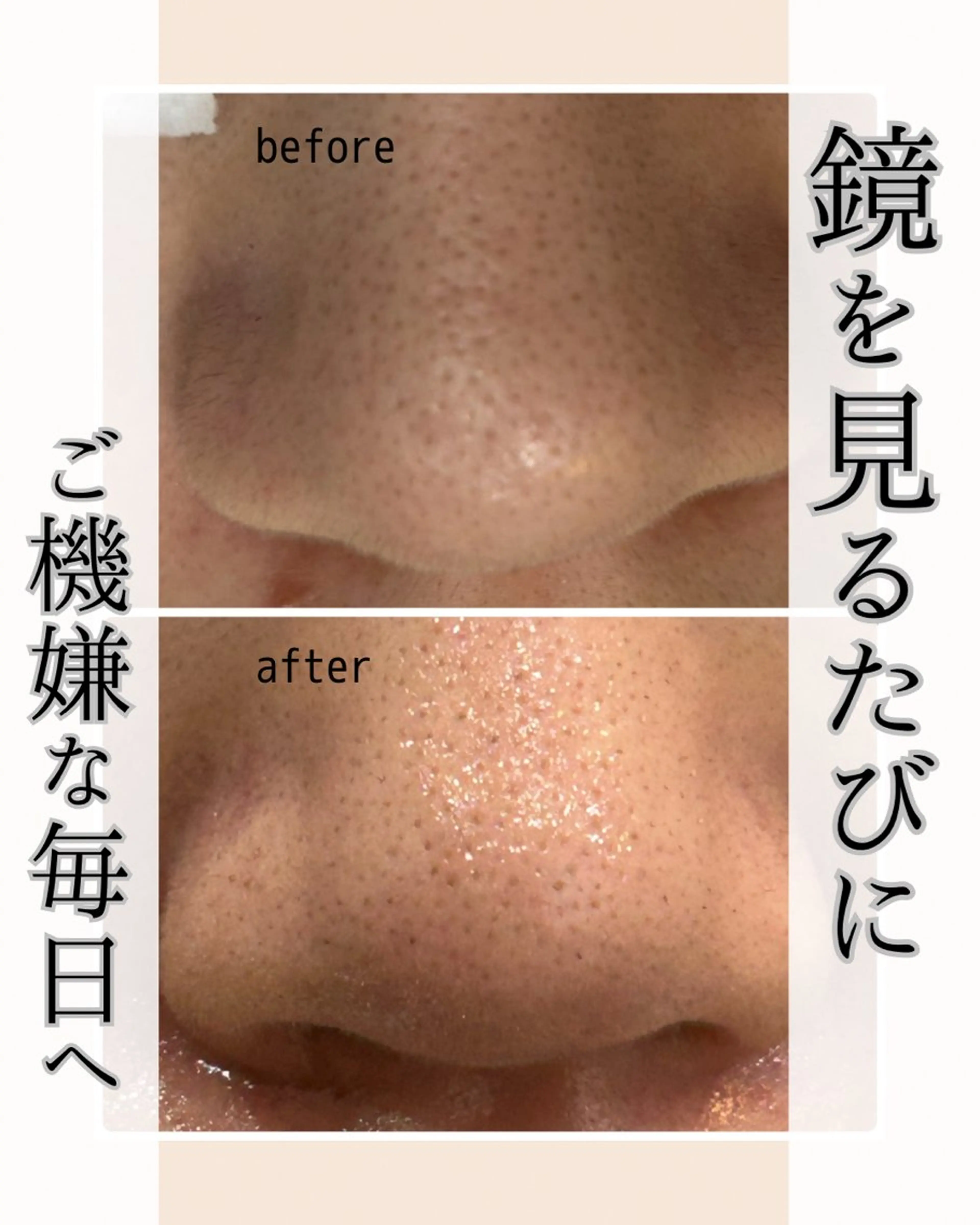 エステ 小顔・毛穴・たるみ ネイル　似内真樹のエステ・リラクイメージ