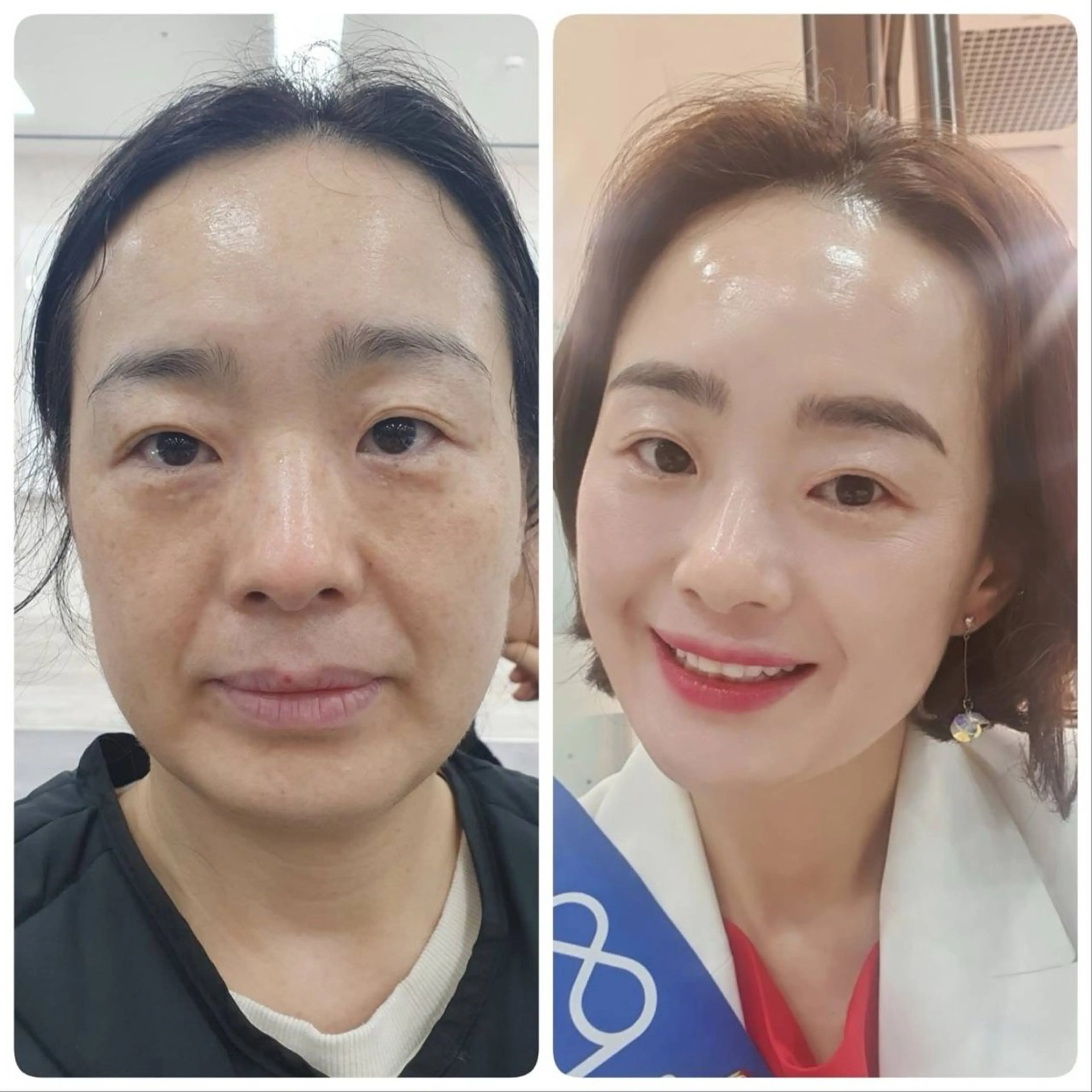 エステ 小顔/たるみ/黒ずみ除去専門サロン/SONA 大和西大寺店所属・【小顔専門看護師 サロンSONA】のエステ・リラクイメージ