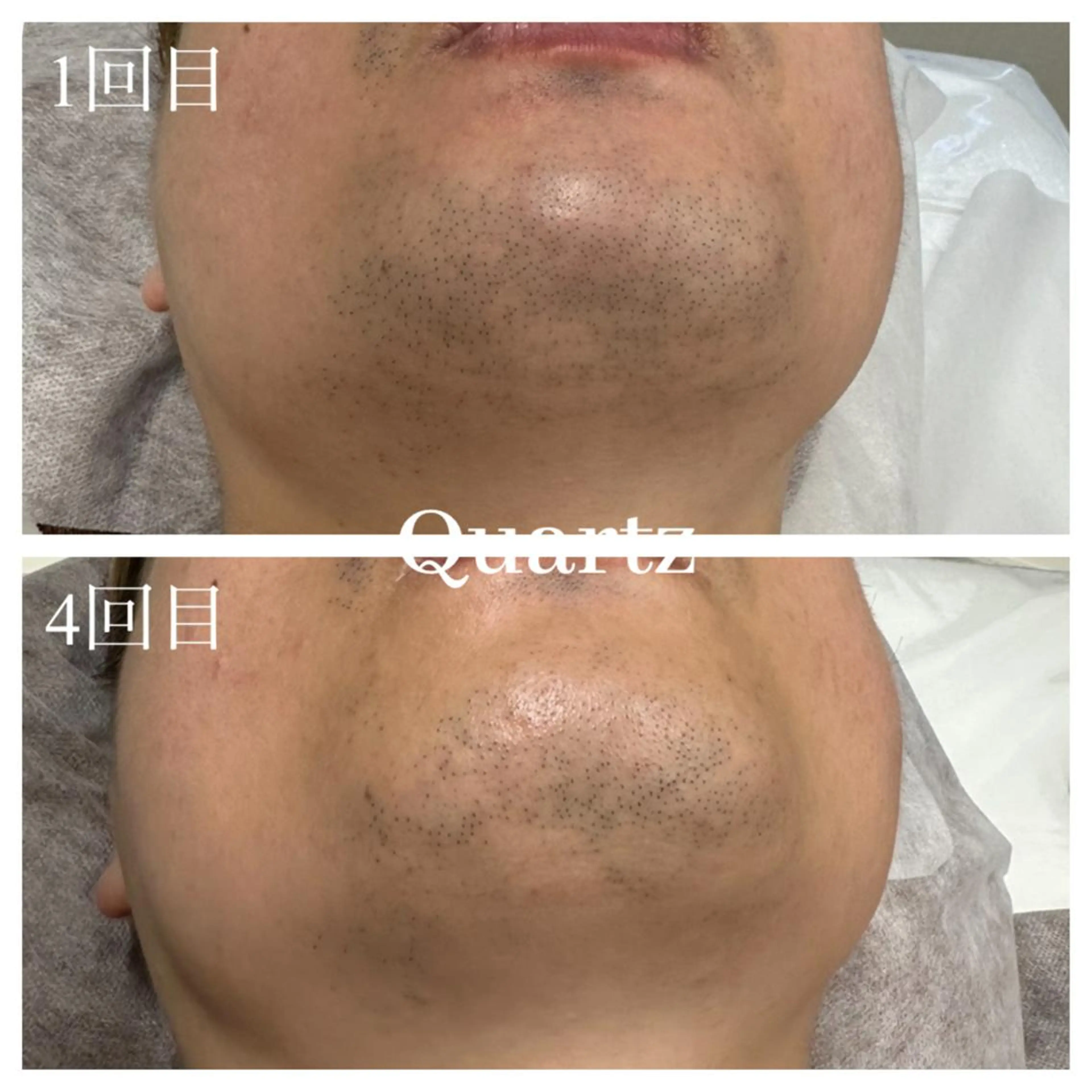 メンズ メンズ専門眉毛＆脱毛サロン【Quartz】所属・メンズ専門眉毛＆脱毛 サロンQuartzのエステ・リラクイメージ