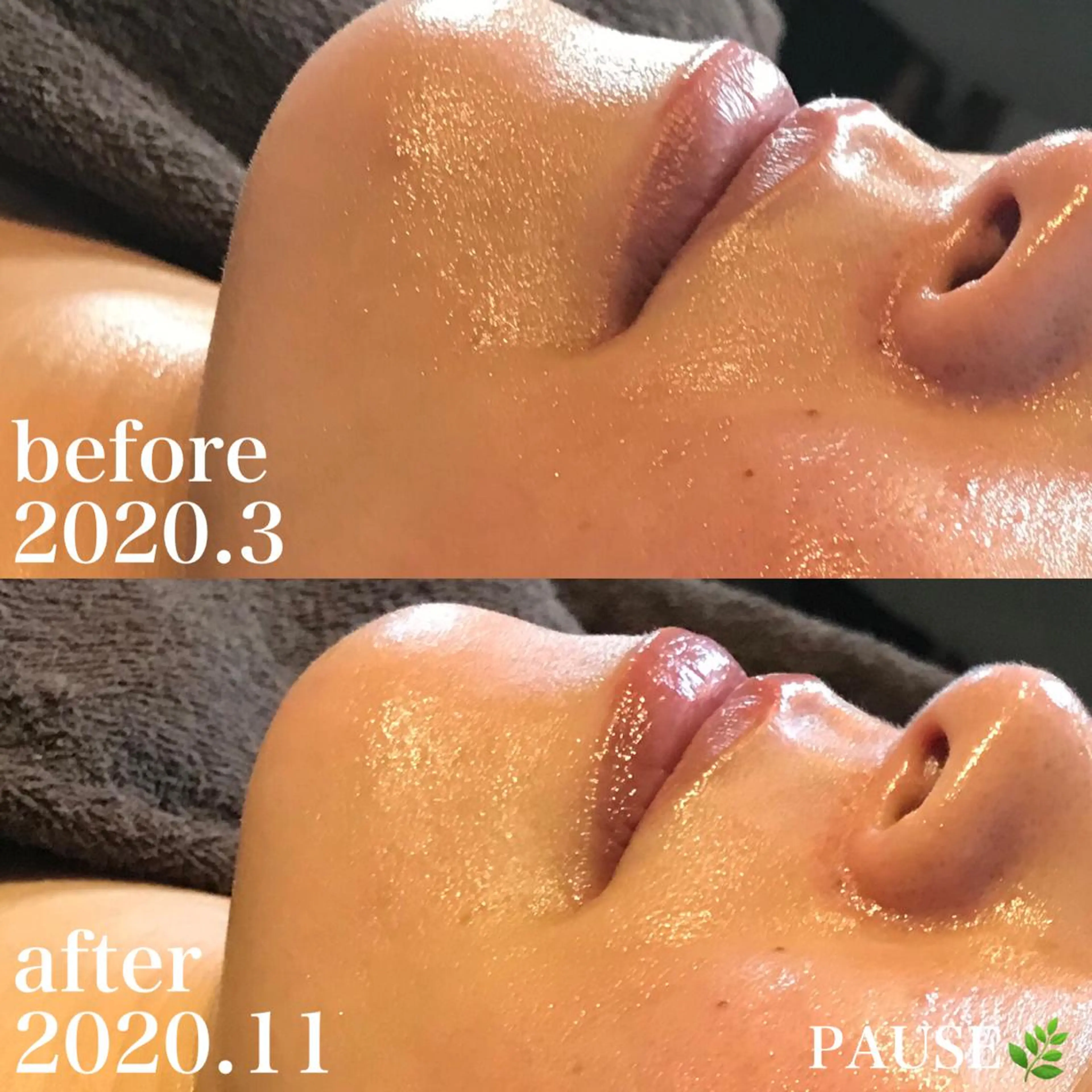 エステ 浜野 恵美のエステ・リラクイメージ