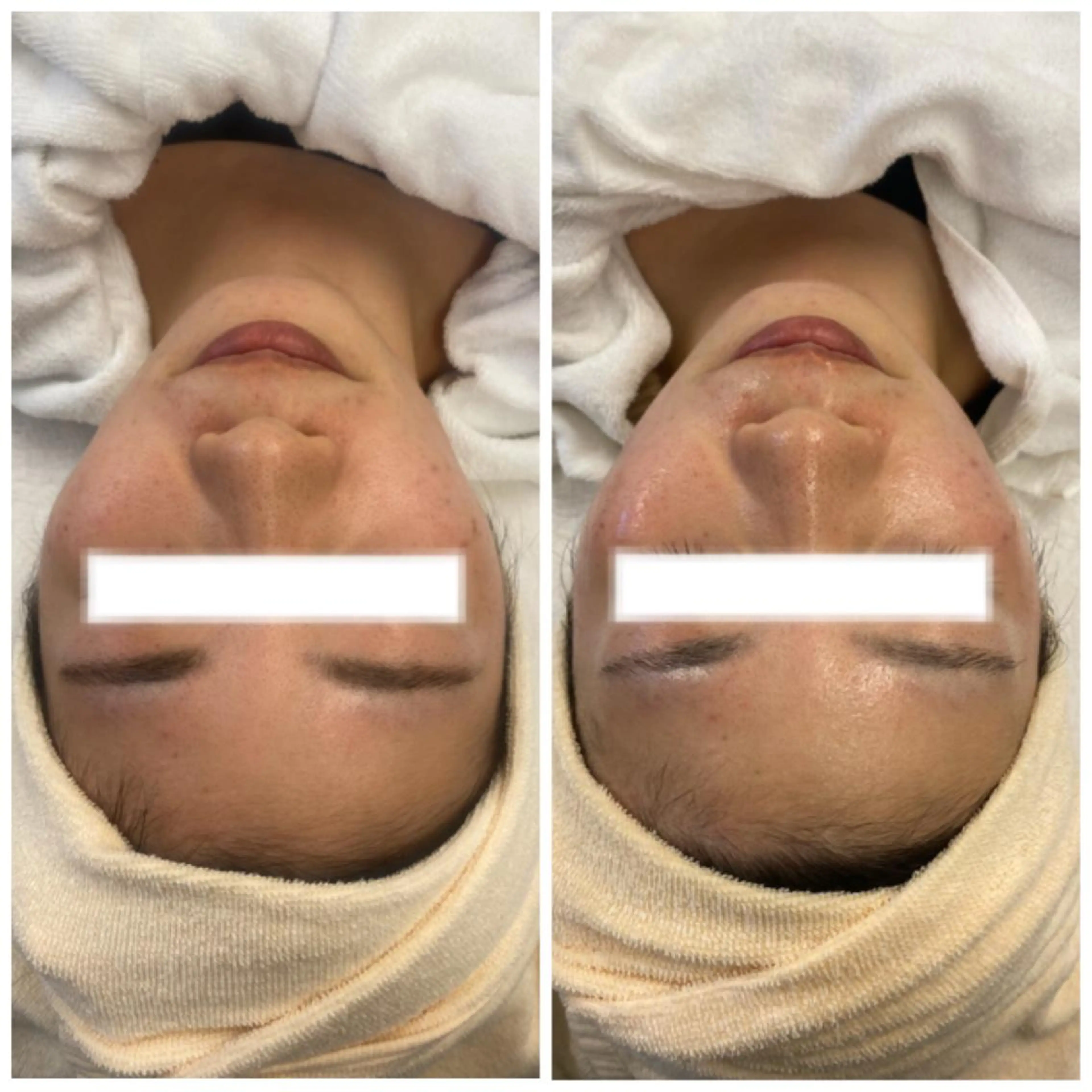 アイブロウ 肌質改善美容サロン ému 用賀のエステ・リラクイメージ