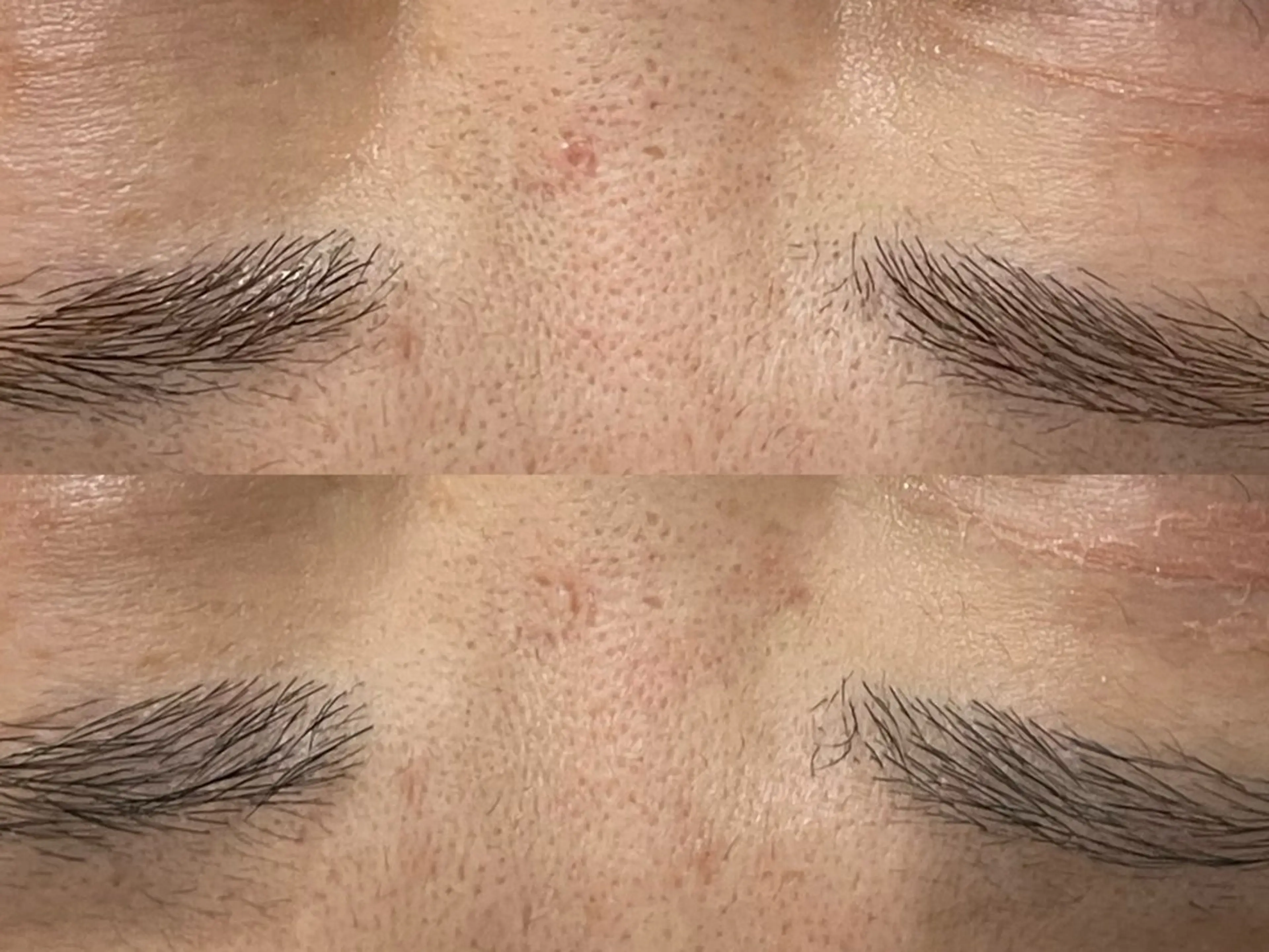 private salon éclat所属・ニキビ・毛穴専門 éclat/エクラのエステ・リラクイメージ