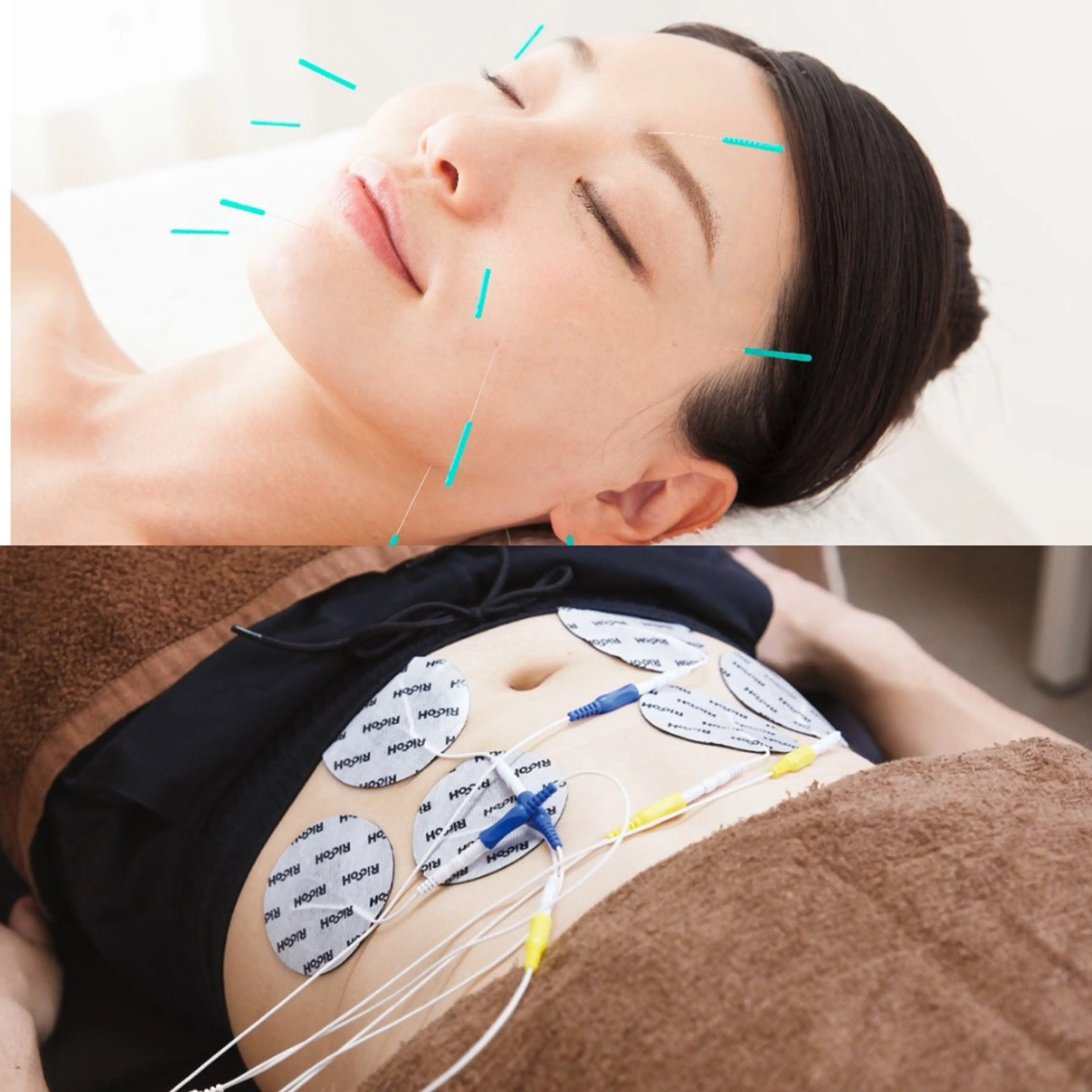 【妊活・美容鍼専門】Aran鍼灸院所属・【美容鍼・不妊専門】 Aran鍼灸院のエステ・リラクイメージ