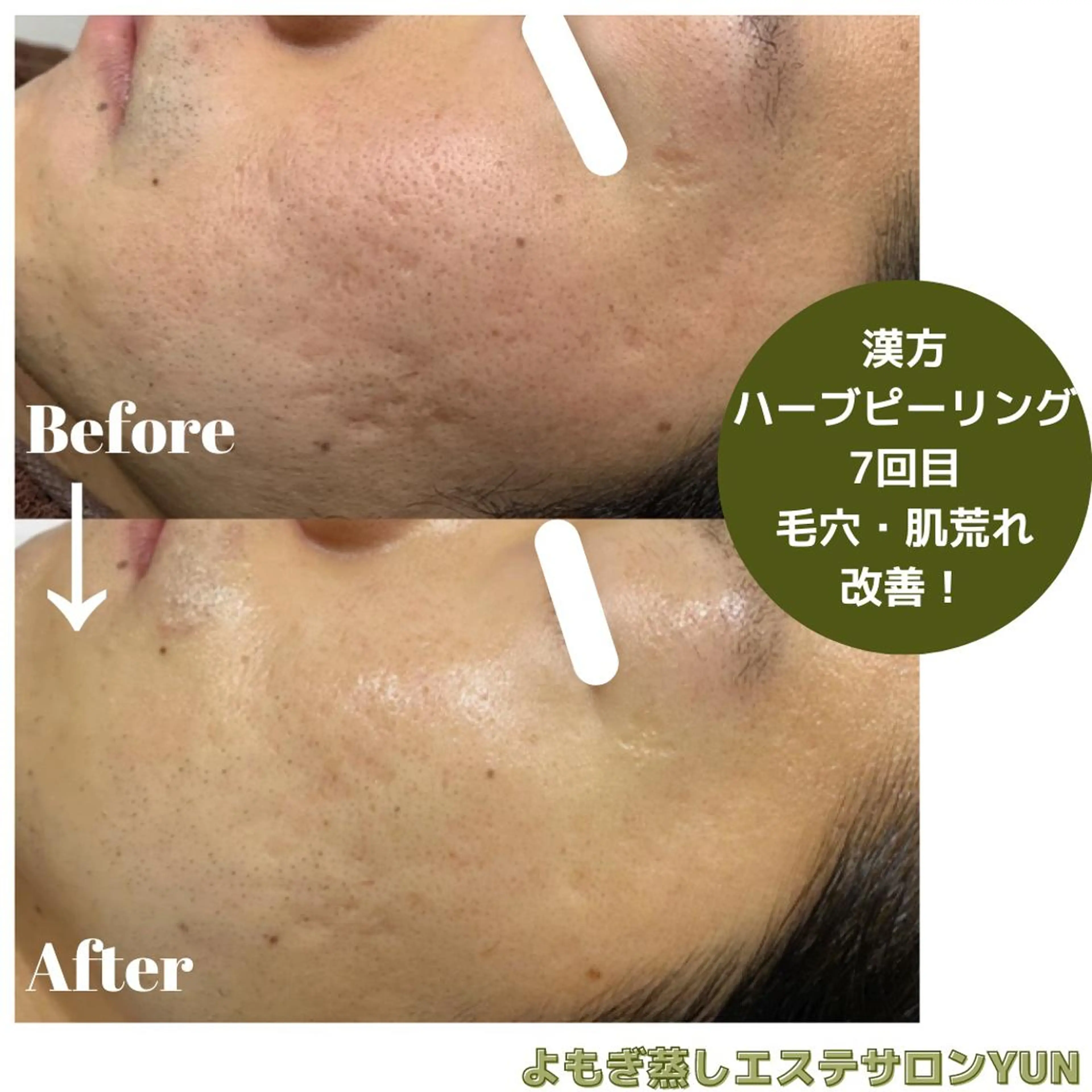 エステ よもぎ蒸しエステサロン★yun所属・よもぎ蒸しサロン ゆんのエステ・リラクイメージ