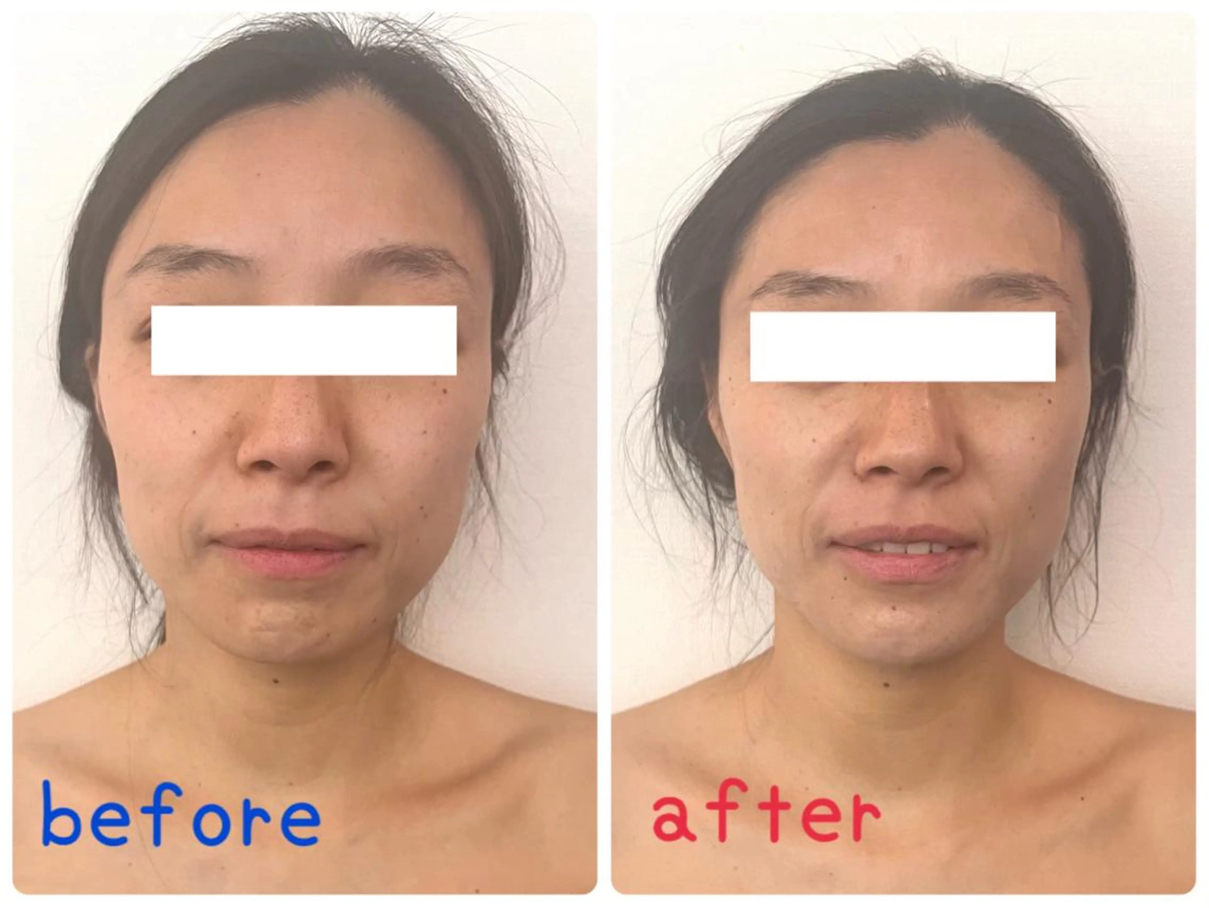 ニキビ・ニキビ跡専門 Solaのエステ・リラクイメージ