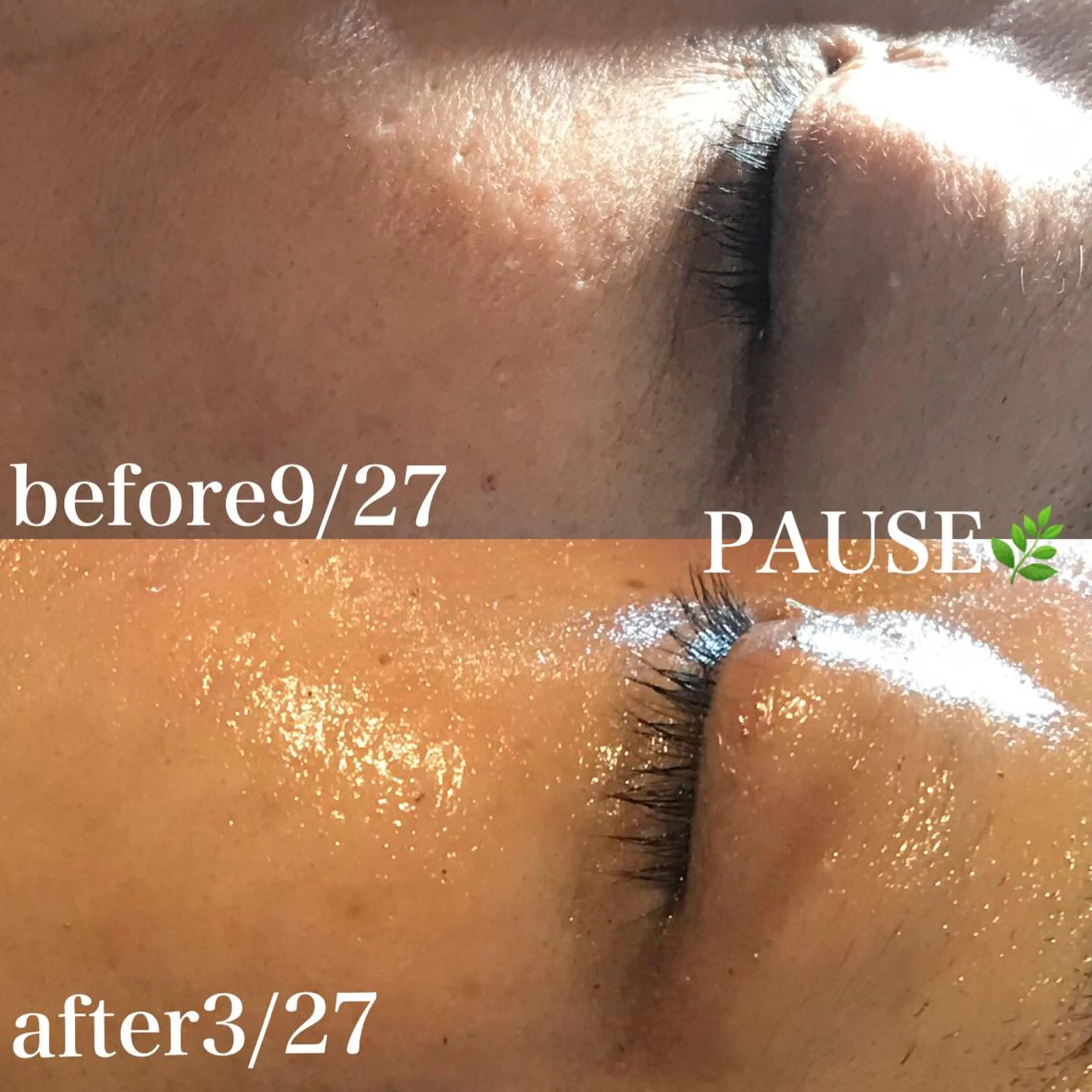 エステ 浜野 恵美のエステ・リラクイメージ