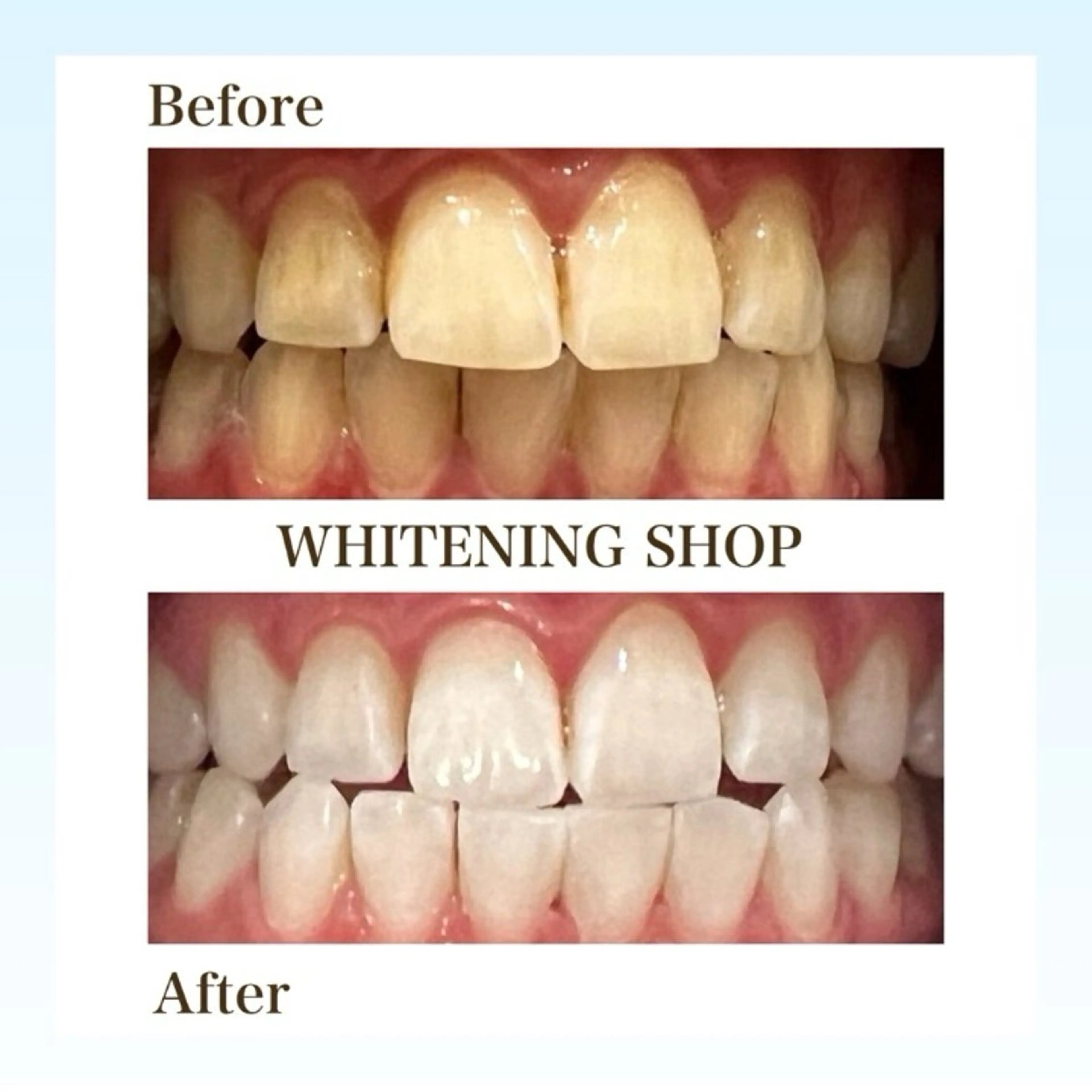 メンズ ホワイトニング ショップくずは店のエステ・リラクイメージ