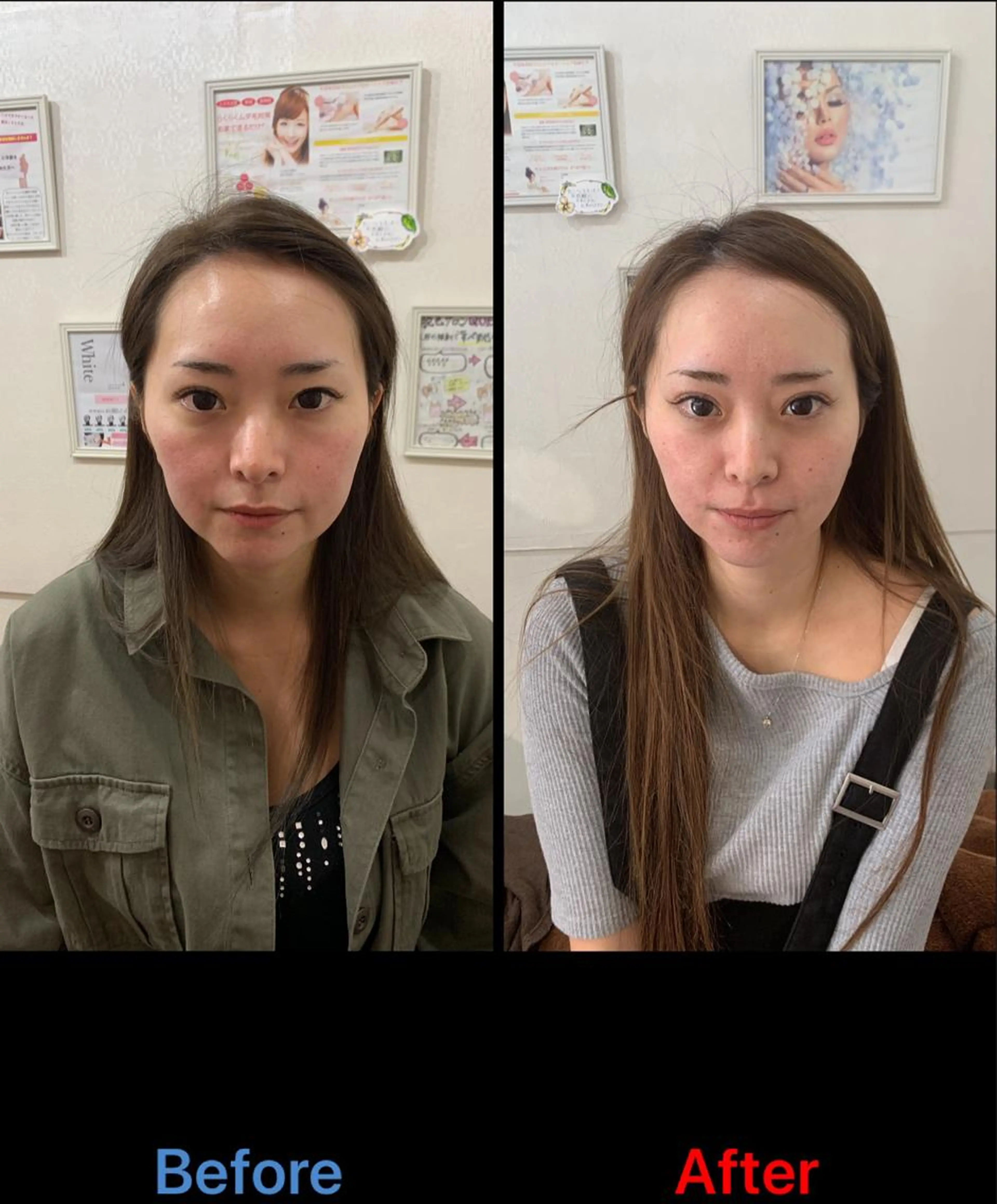 たるみ・しわ・くすみ・毛穴の開きが気になる方【光フェイシャル】1回　￥5500の写真