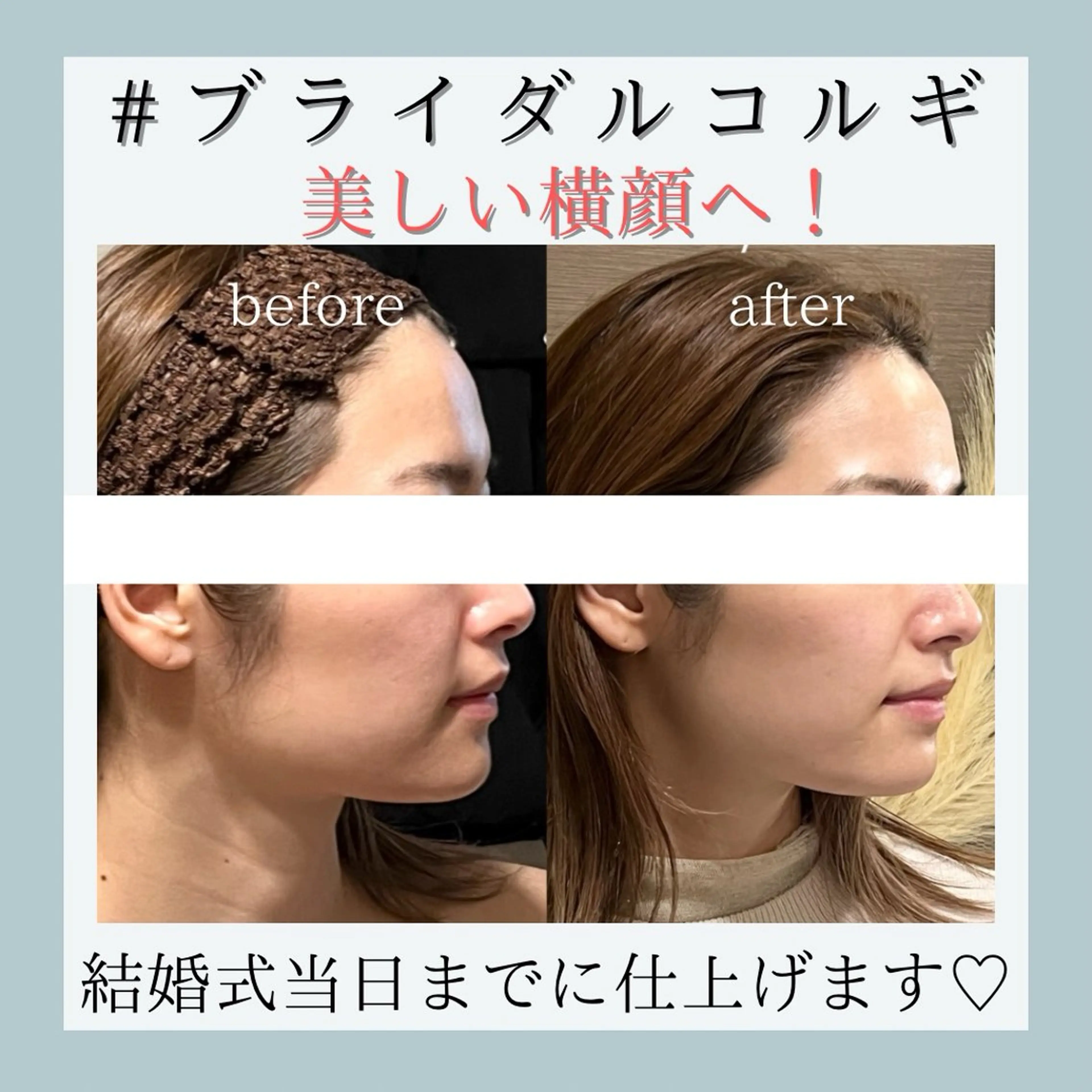 小嶋萌 今池駅徒歩2分のエステ・リラクイメージ