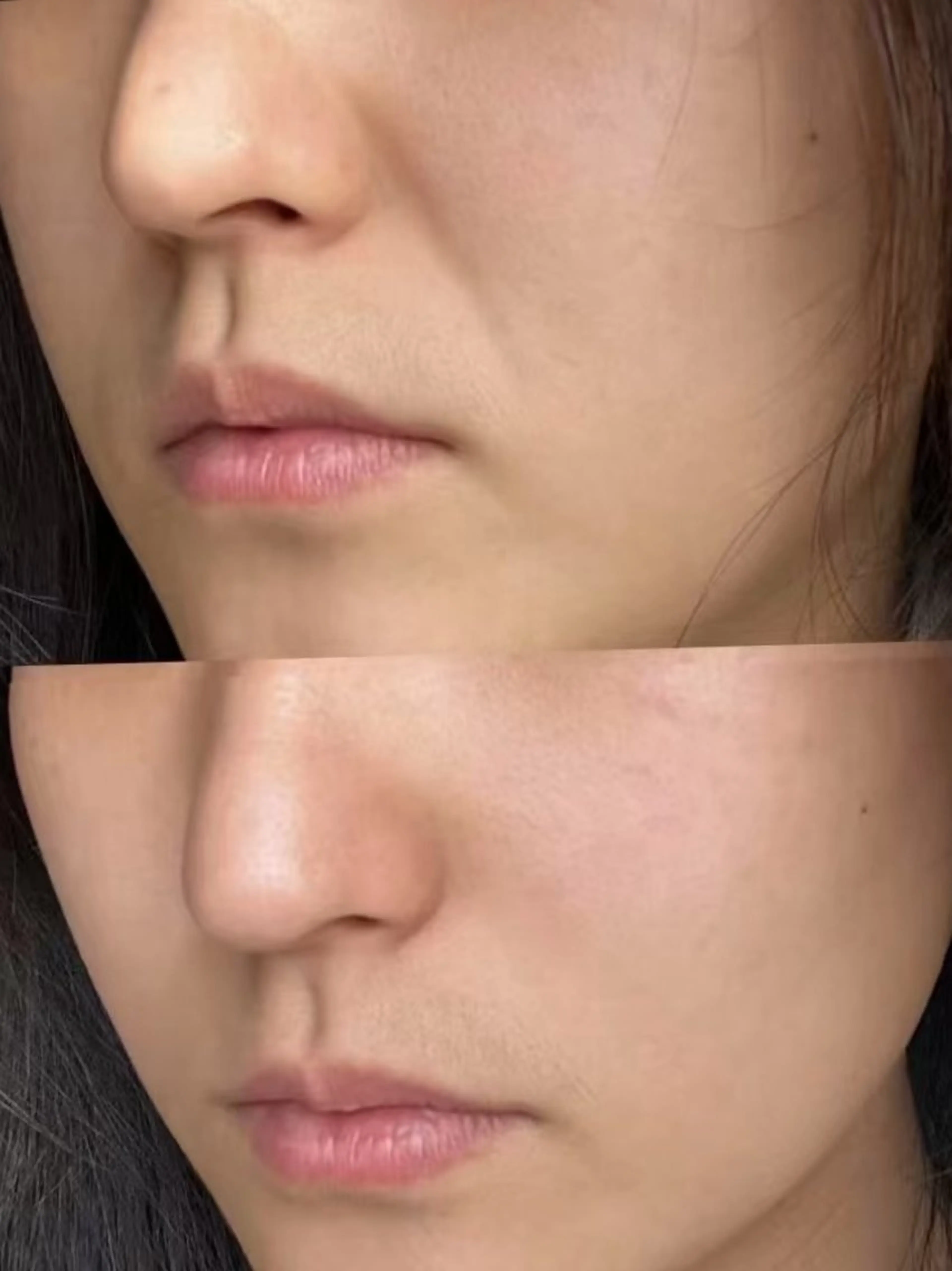 エステ aliaハイフ&水光ジェットサロン所属・aliaハーブ水光店 エステティシャン募集のエステ・リラクイメージ