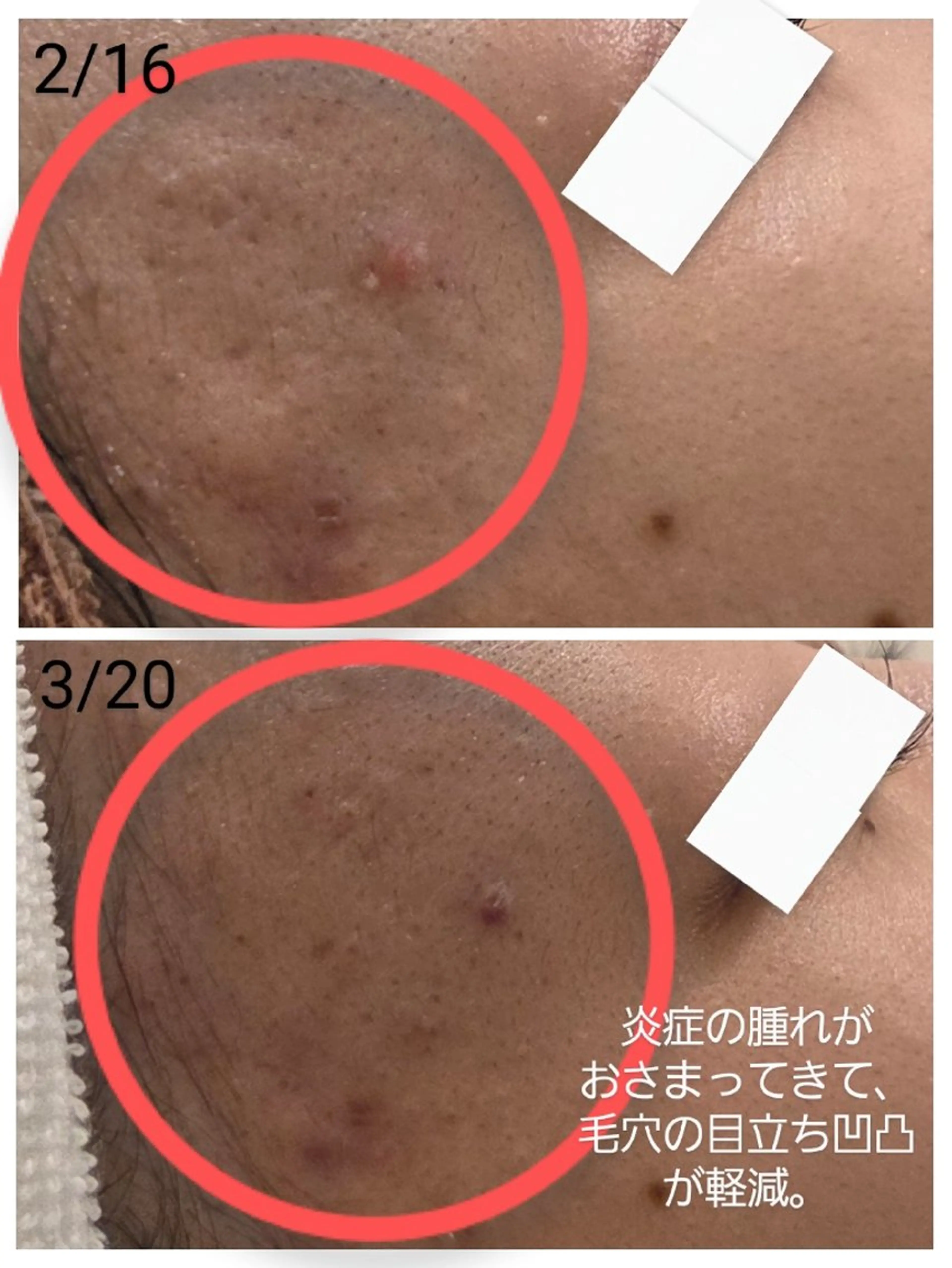 エステ 上尾Luce. あきやまのエステ・リラクイメージ