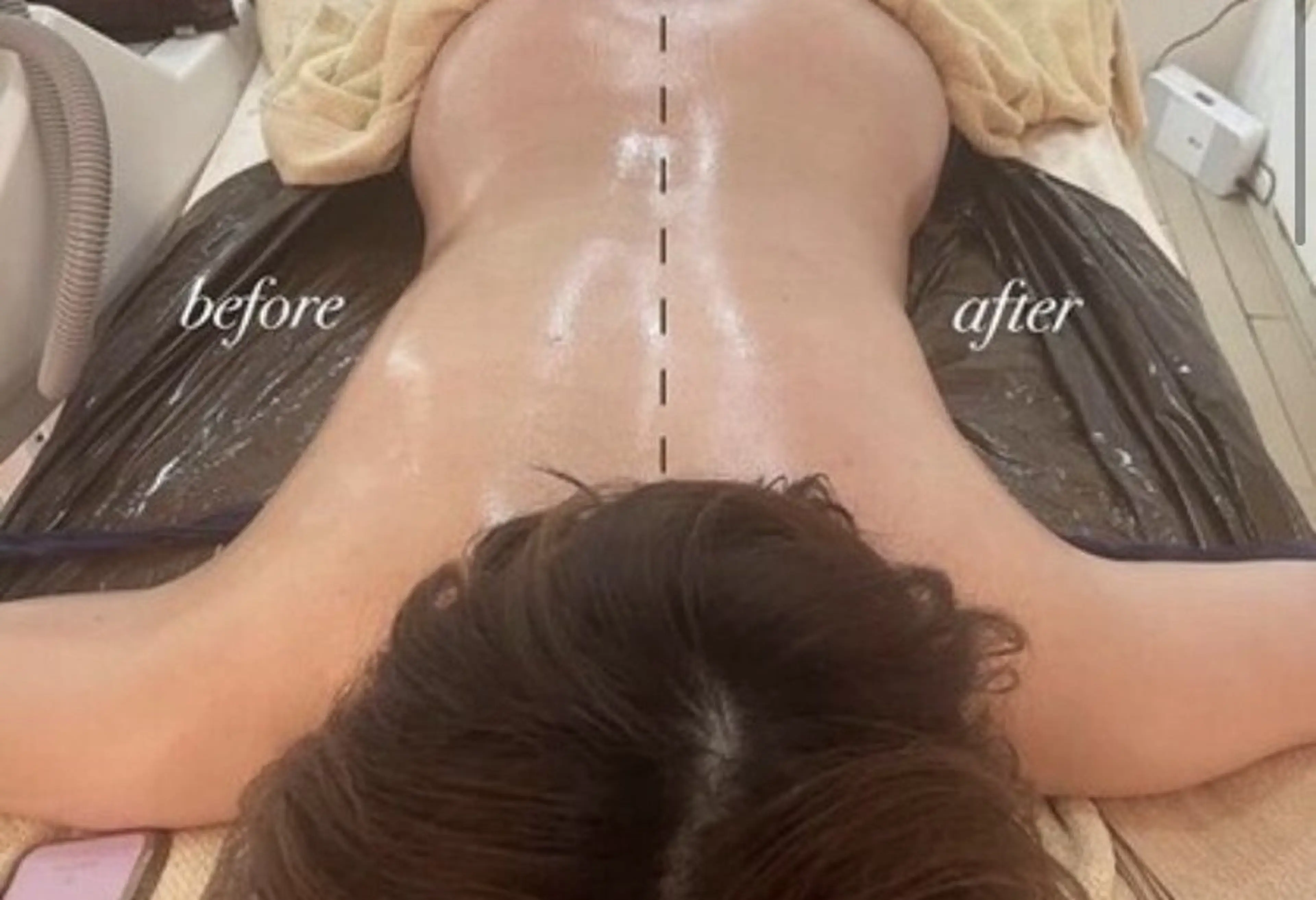 今だけ価格❣️【セルライトケア全身50分】吸引マシンでむくみや凝りに✨の写真