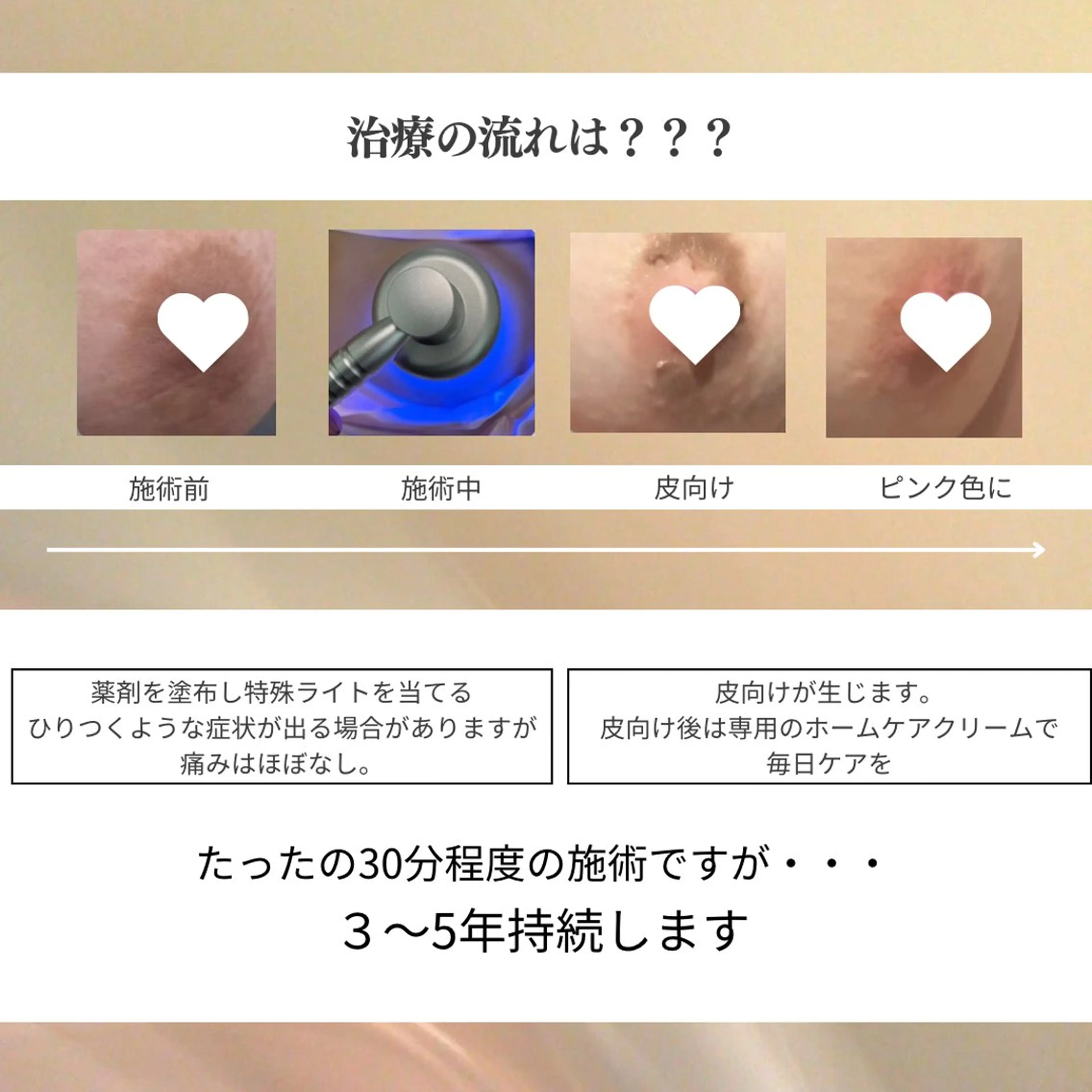 看護師 AYUIのエステ・リラクイメージ