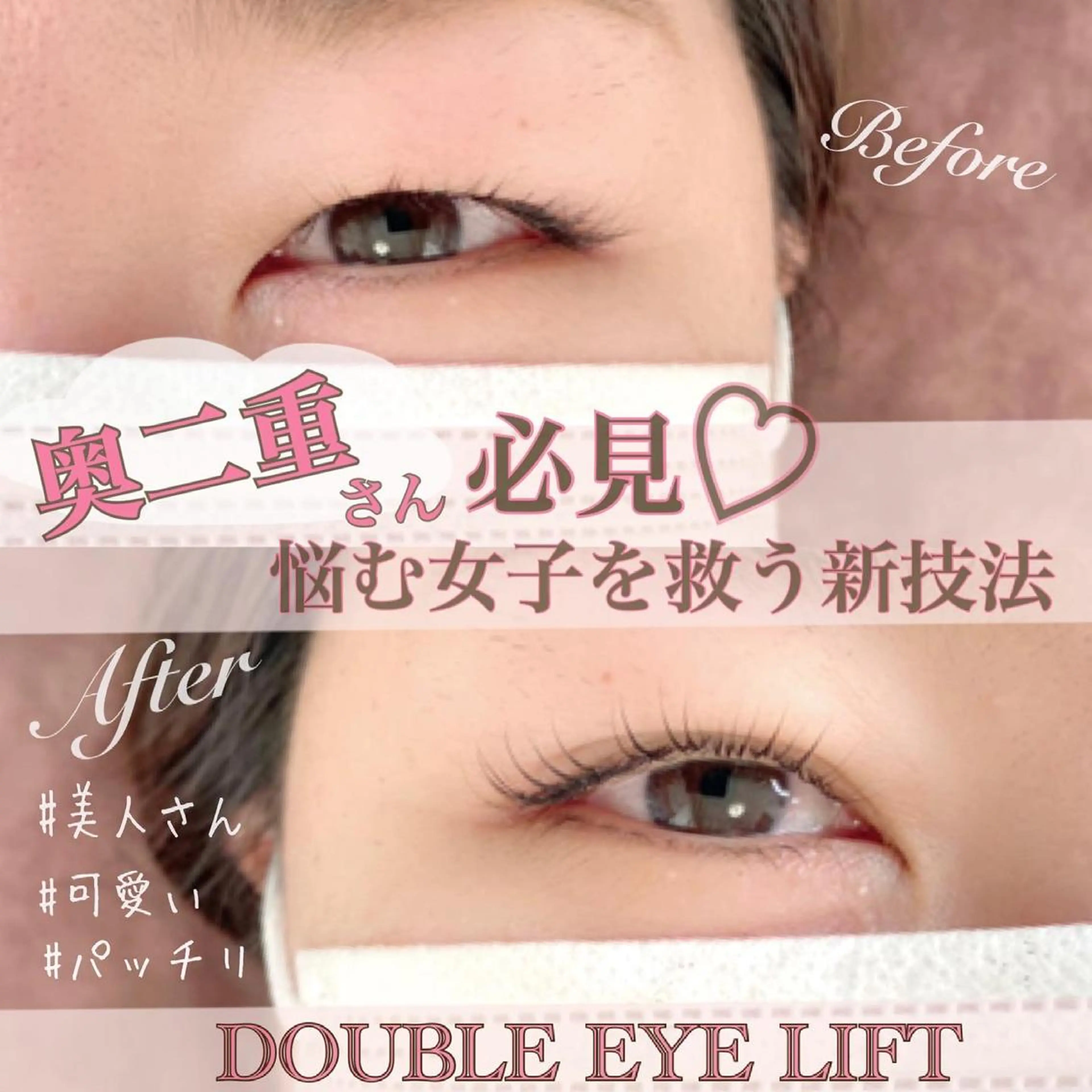 神戸校認定講師がダブルアイリフトで皆様のお悩みを解決！！一重、奥二重さんにとって夢のような技術♡の写真