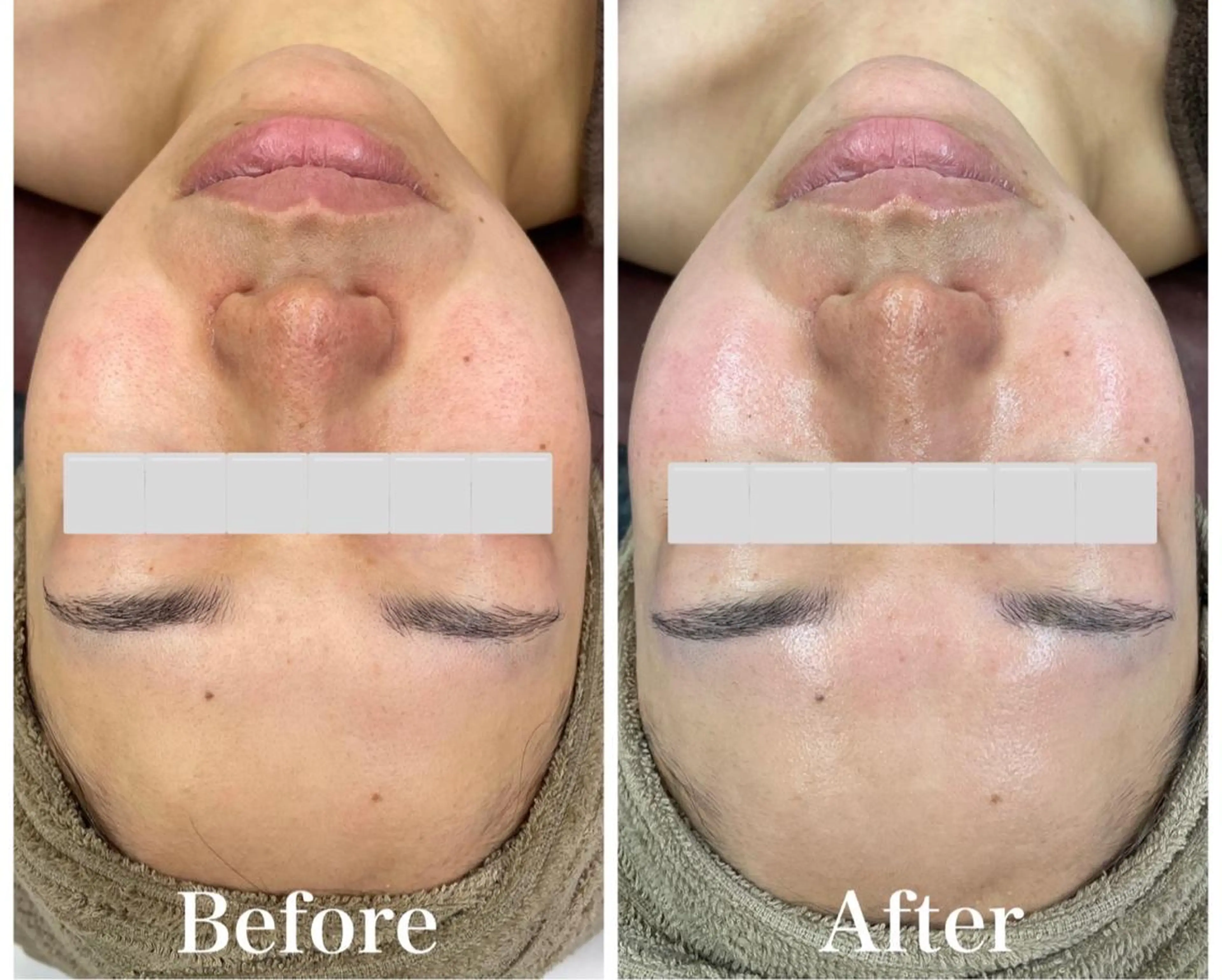 陶肌トリートメントの写真