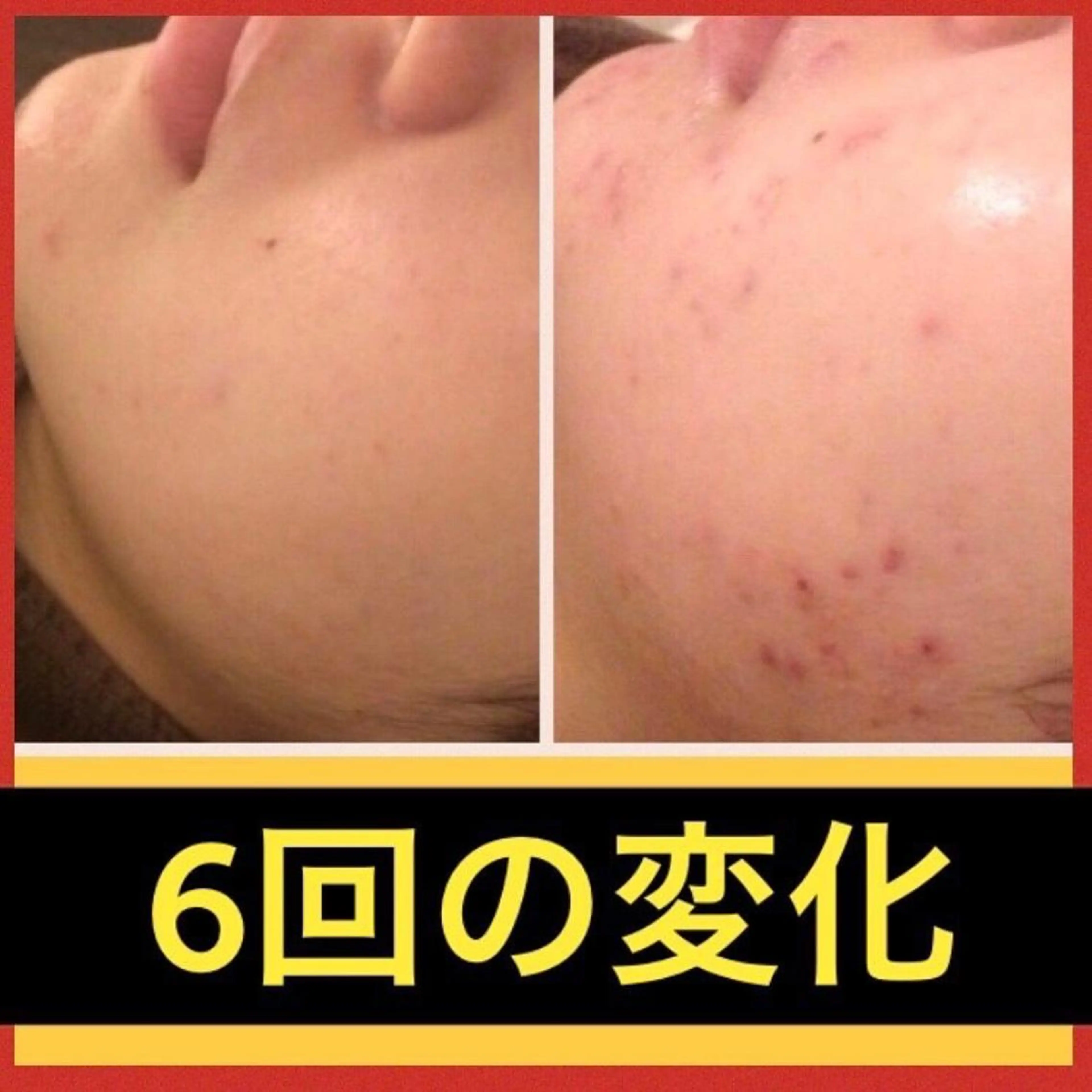 セミロング カラー パーマ ヘアアレンジ メンズ キッズ ネイル マツエク・マツパ アイブロウ エステ リラク ニキビ特化型エステ 🍓最短で肌質改善のエステ・リラクイメージ