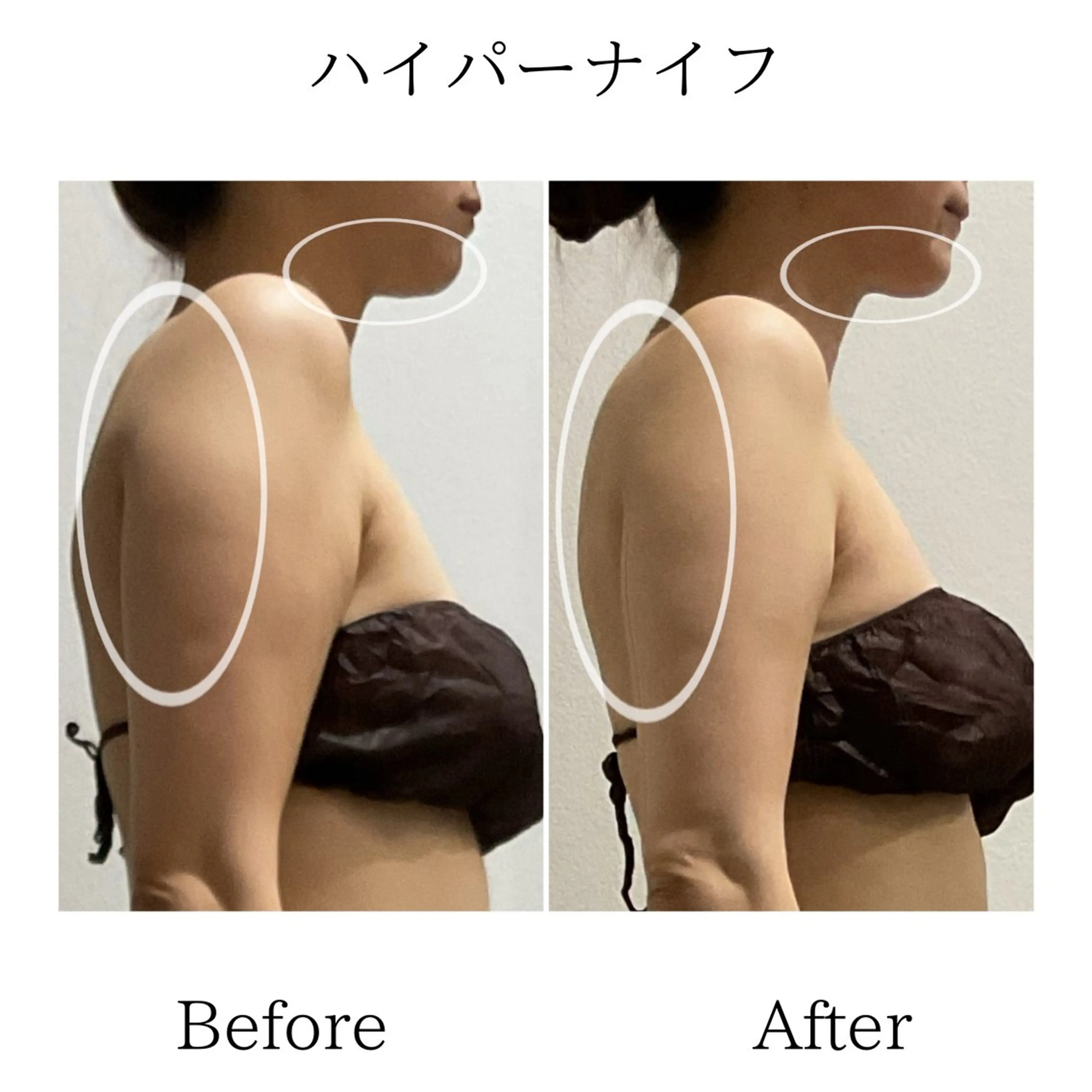 エステ LiLL by Andre beauty所属・LiLL 熊本のその他イメージ