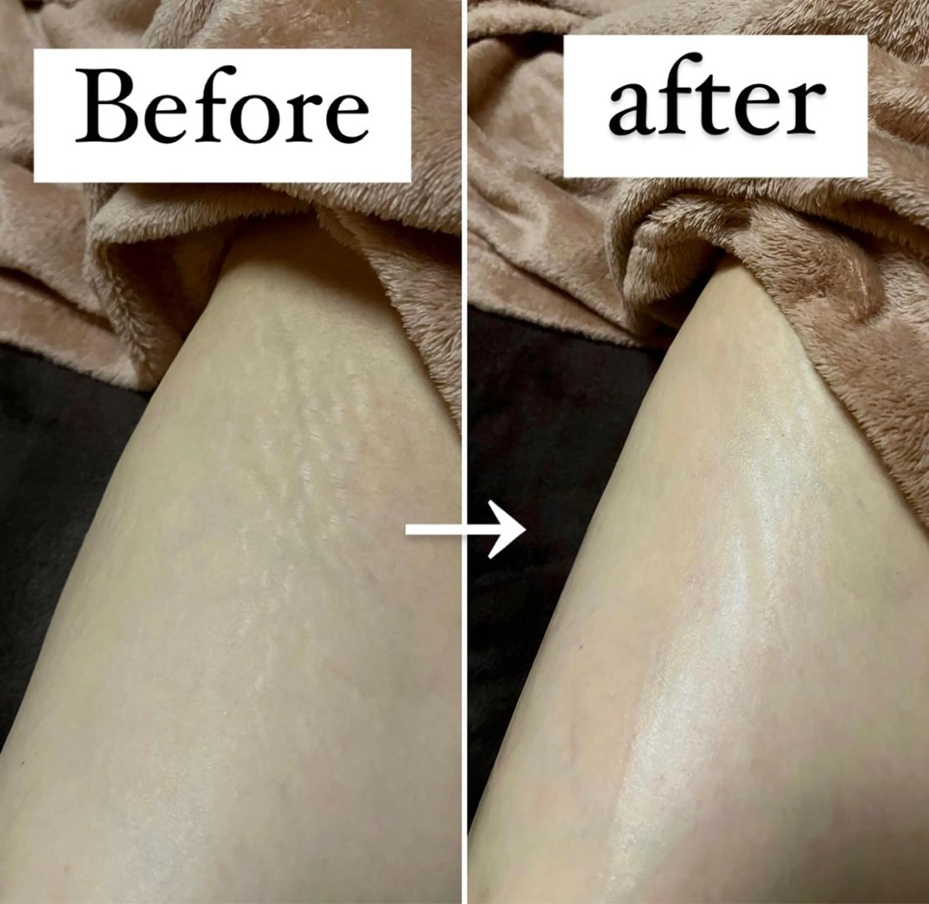 アイカワールド所属・鈴木 愛加のエステ・リラクイメージ