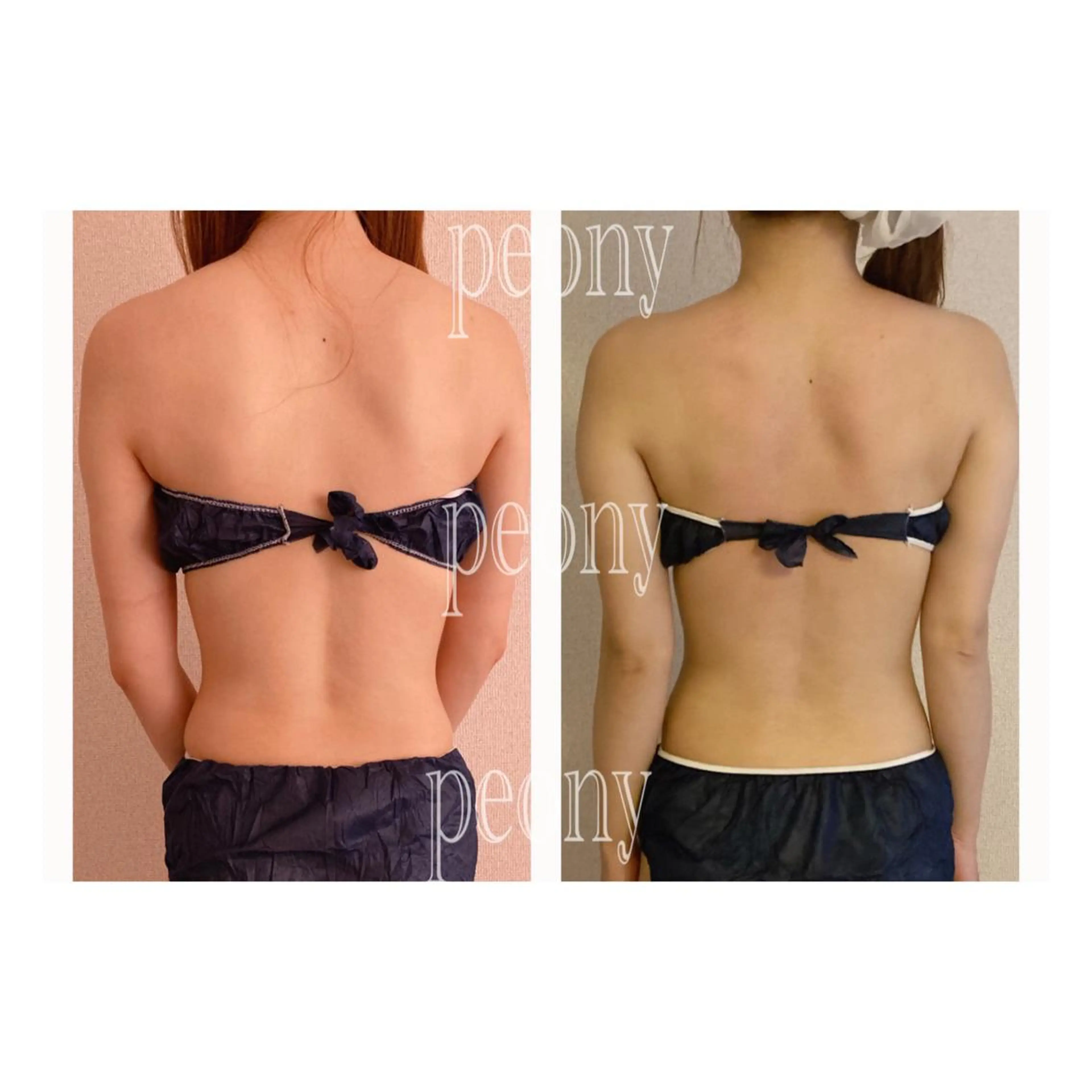 デトックス美容専門サロンｐｅｏｎｙ所属・デトックス美容専門 サロンｐｅｏｎｙのエステ・リラクイメージ