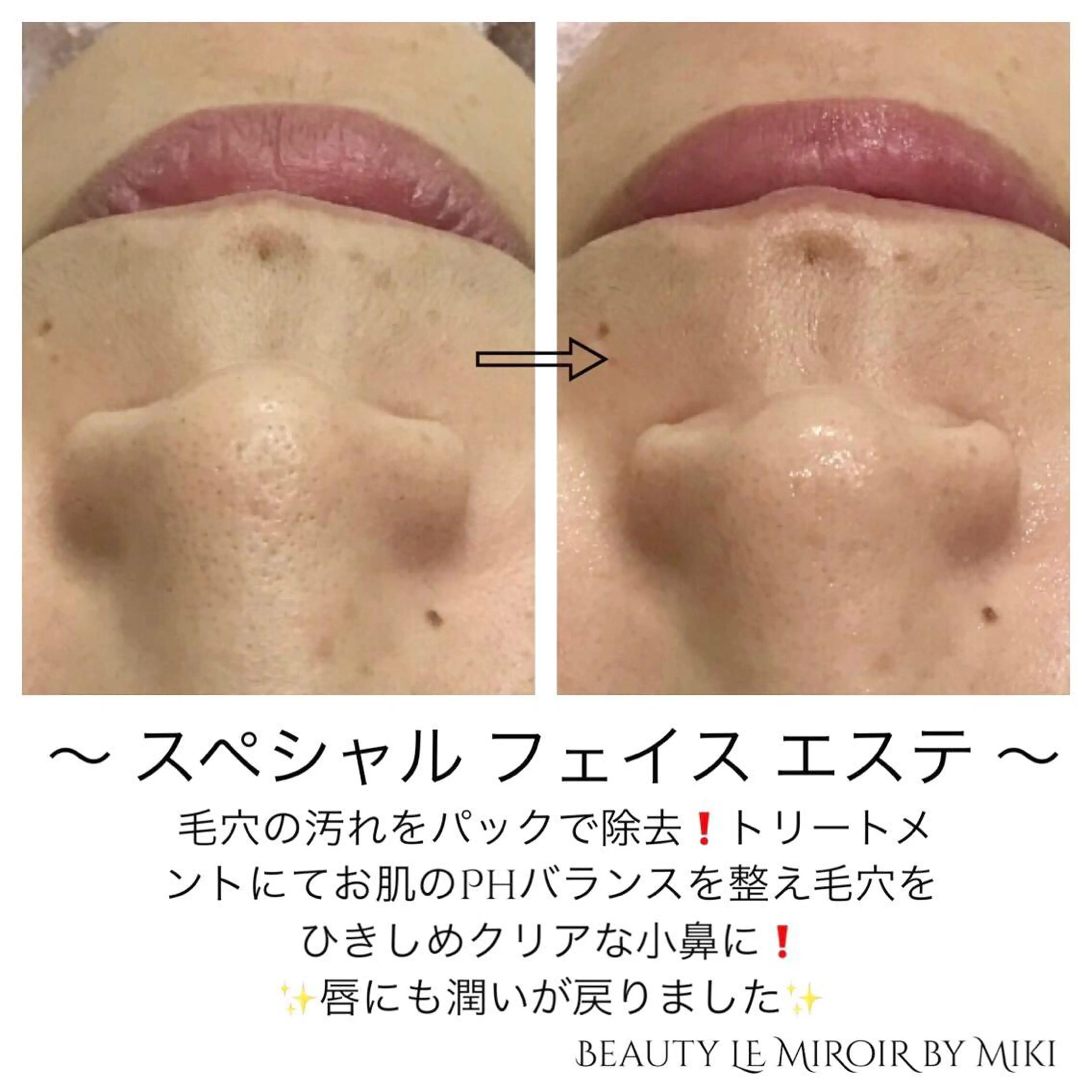 ビューティー ミロワールのエステ・リラクイメージ