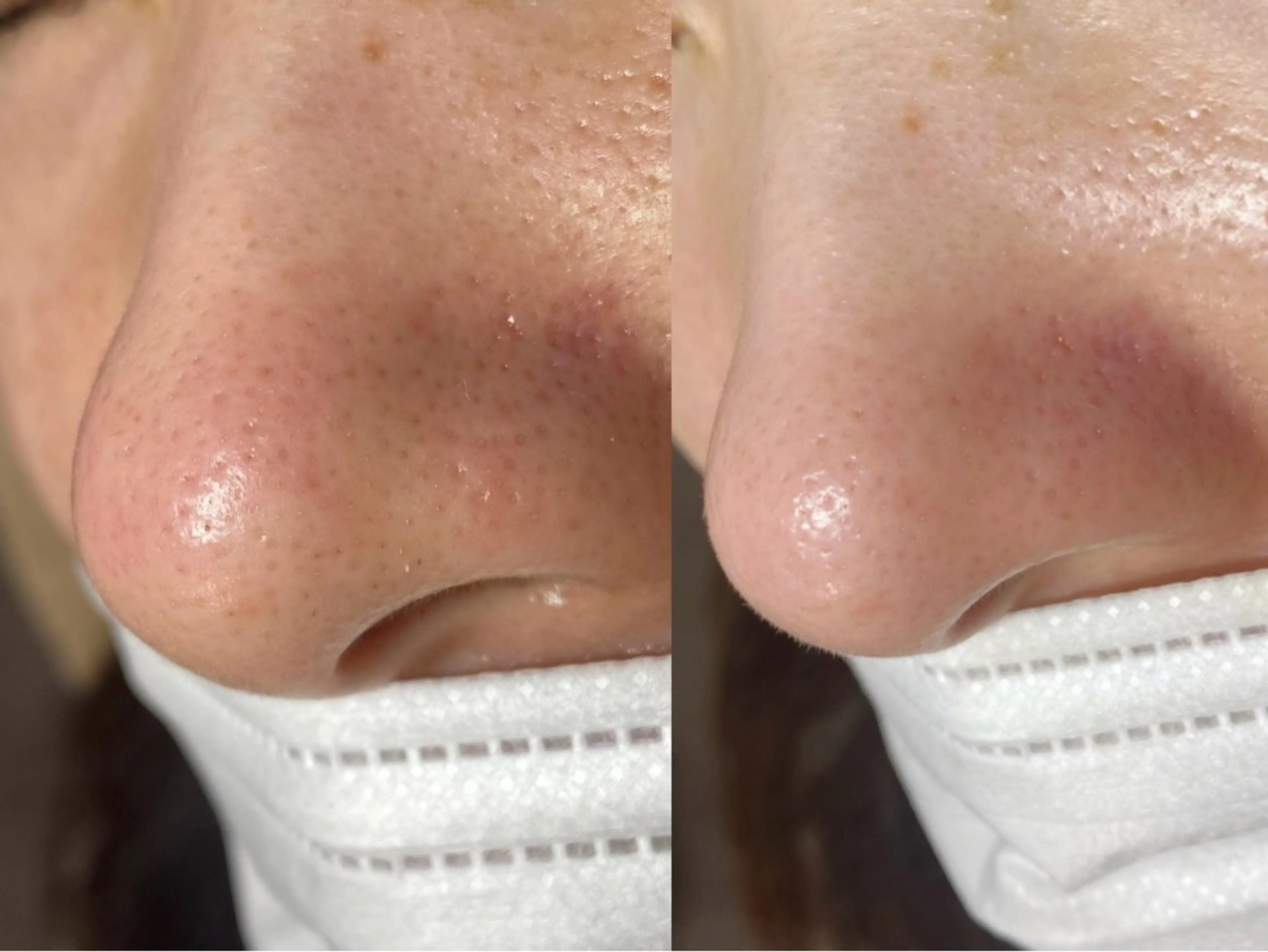 mone~total care salon~所属・mone (モーネ)のマツエク・マツパデザイン