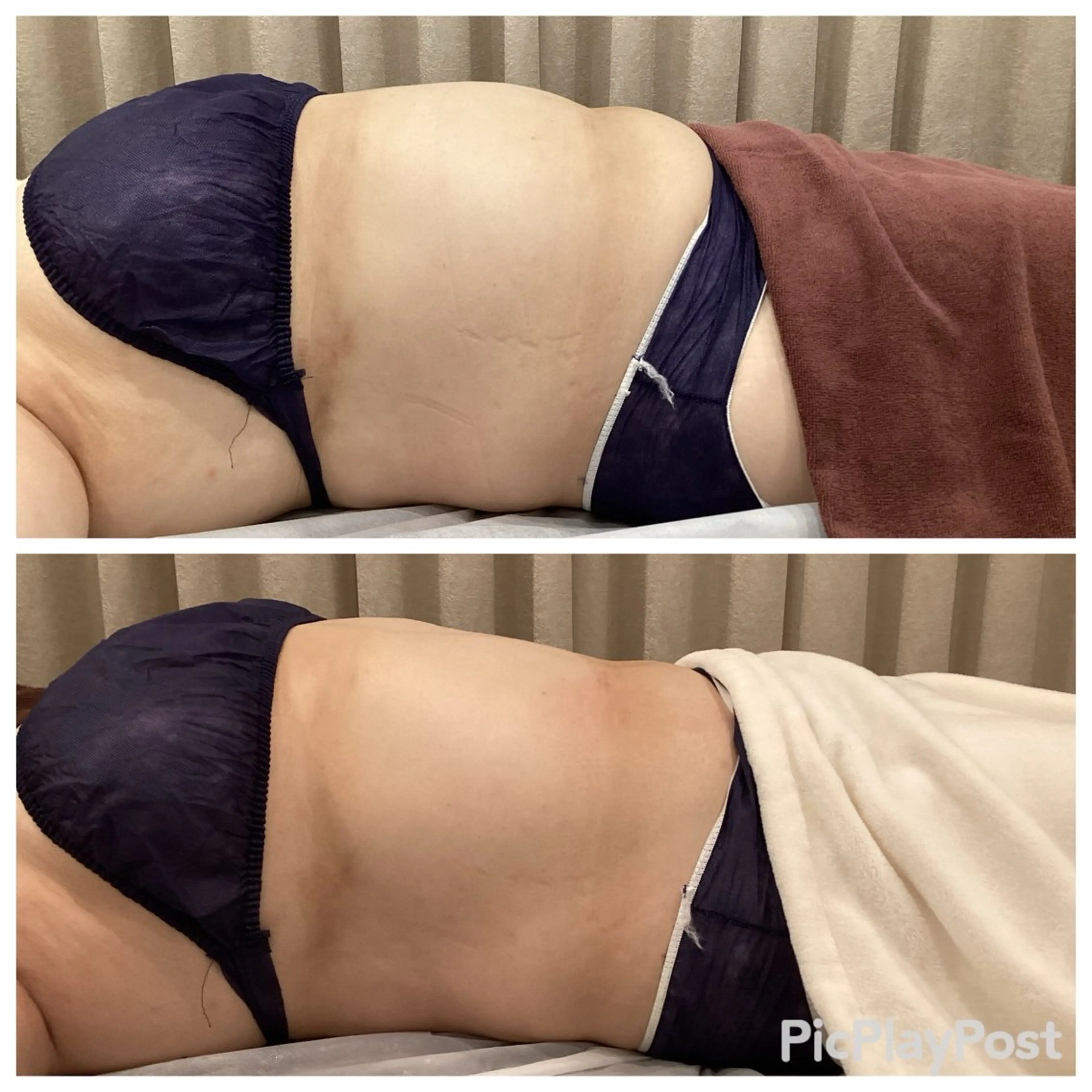 しっかり結果を◎特許取得キャビテーション【キャビゼロ】60分コース（上半身or下半身）の写真