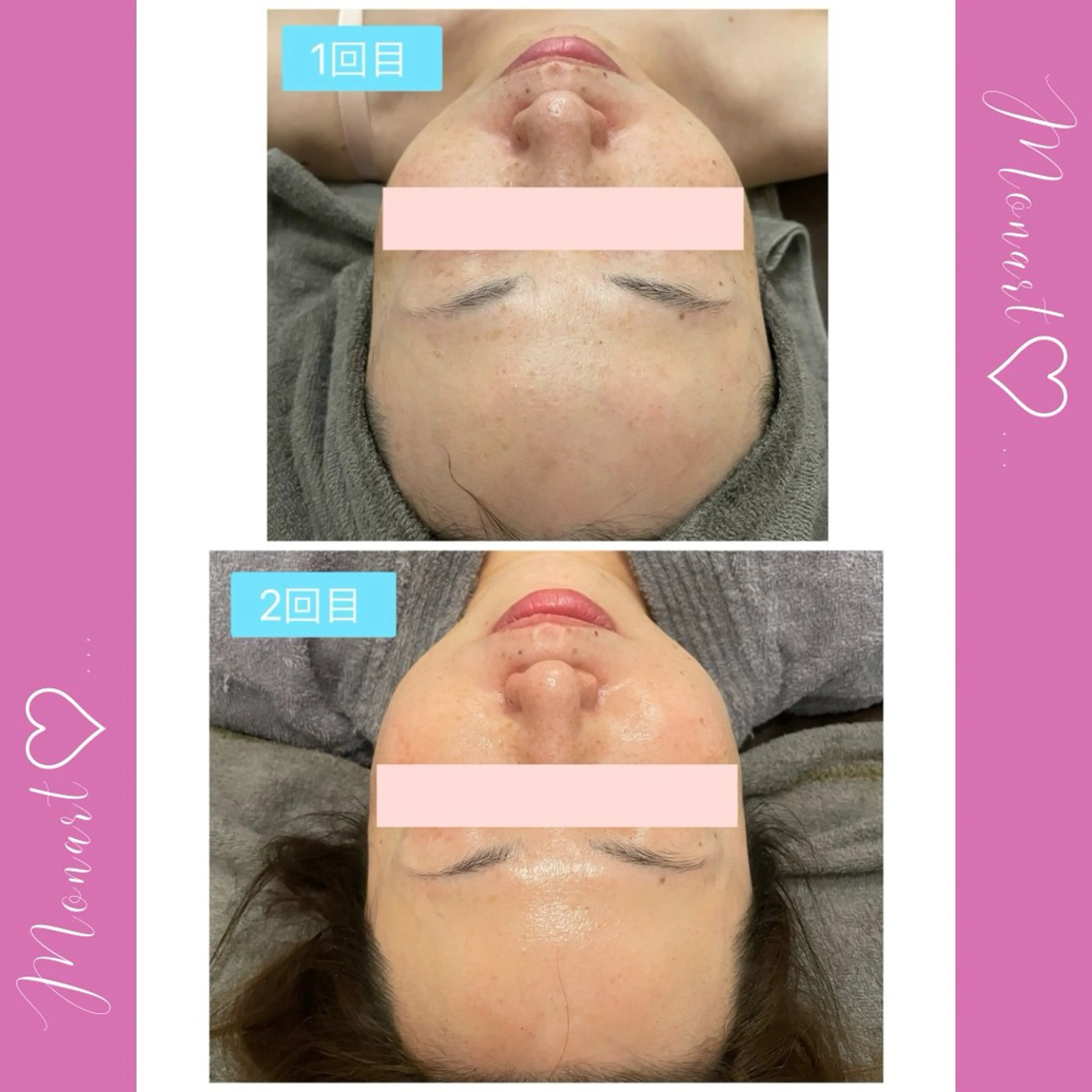 Monart -deux-のエステ・リラクイメージ