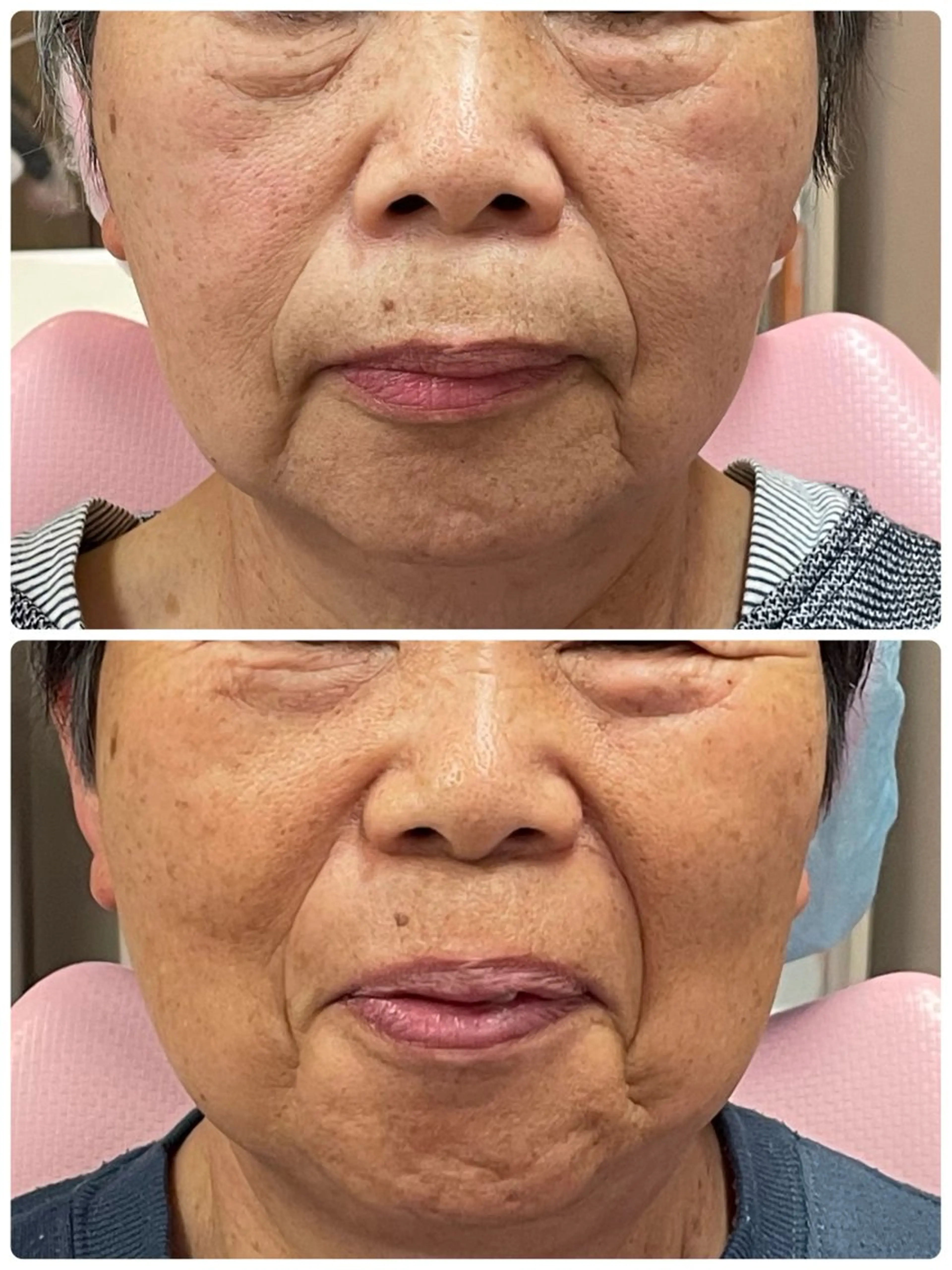 Salon Rion所属・Rion 野々村のエステ・リラクイメージ