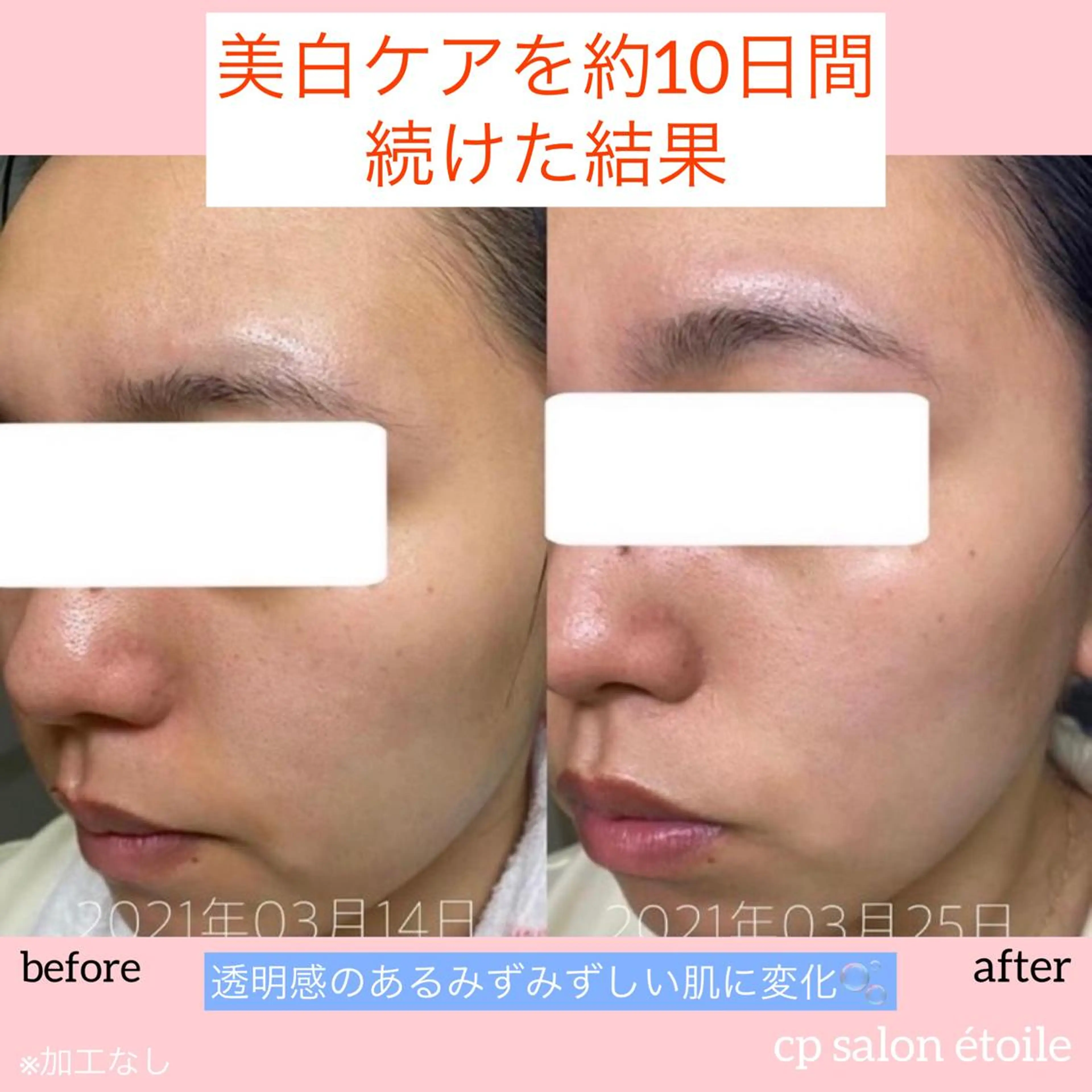 エステ pansy(パンジー)上野フェイシャルエステ専門店所属・pansy saraのエステ・リラクイメージ