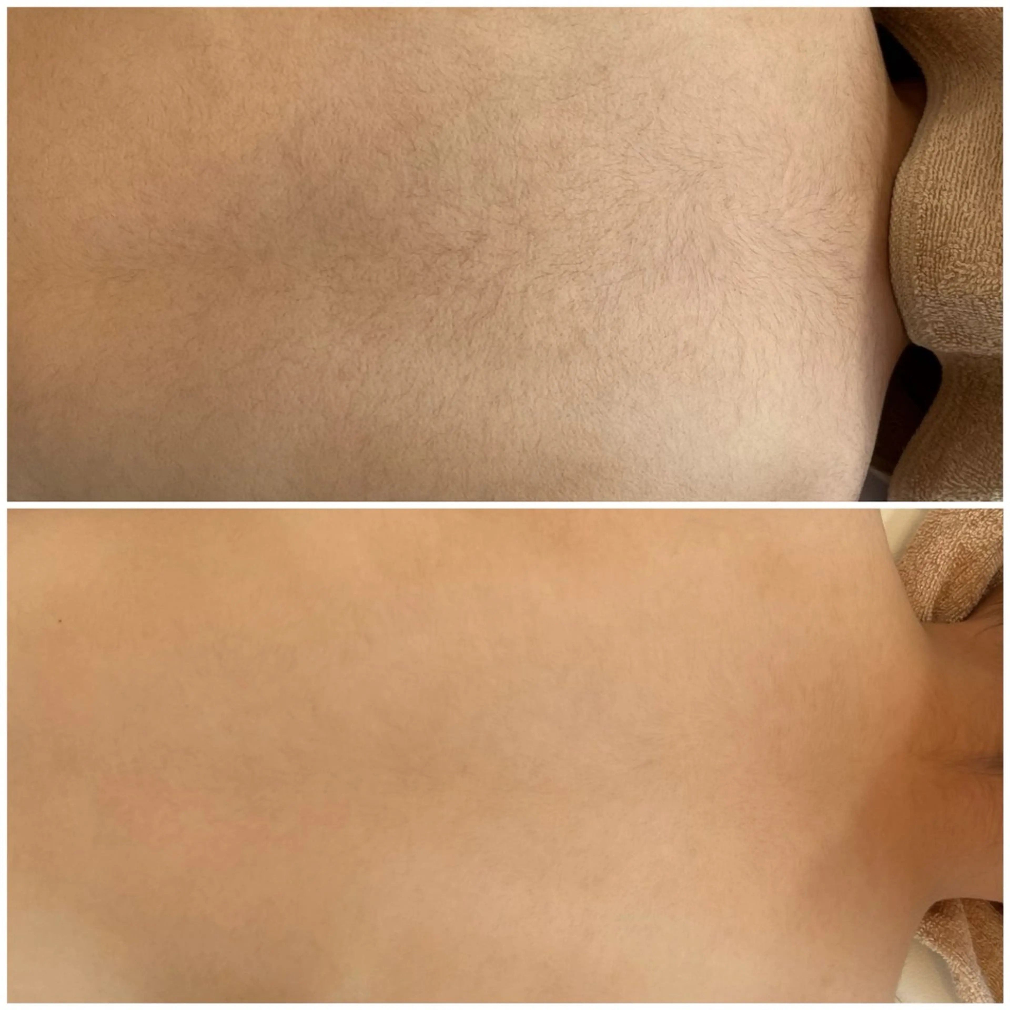 キッズ 脱毛 脱毛エステサロンViViPirina所属・軽部 歩のエステ・リラクイメージ