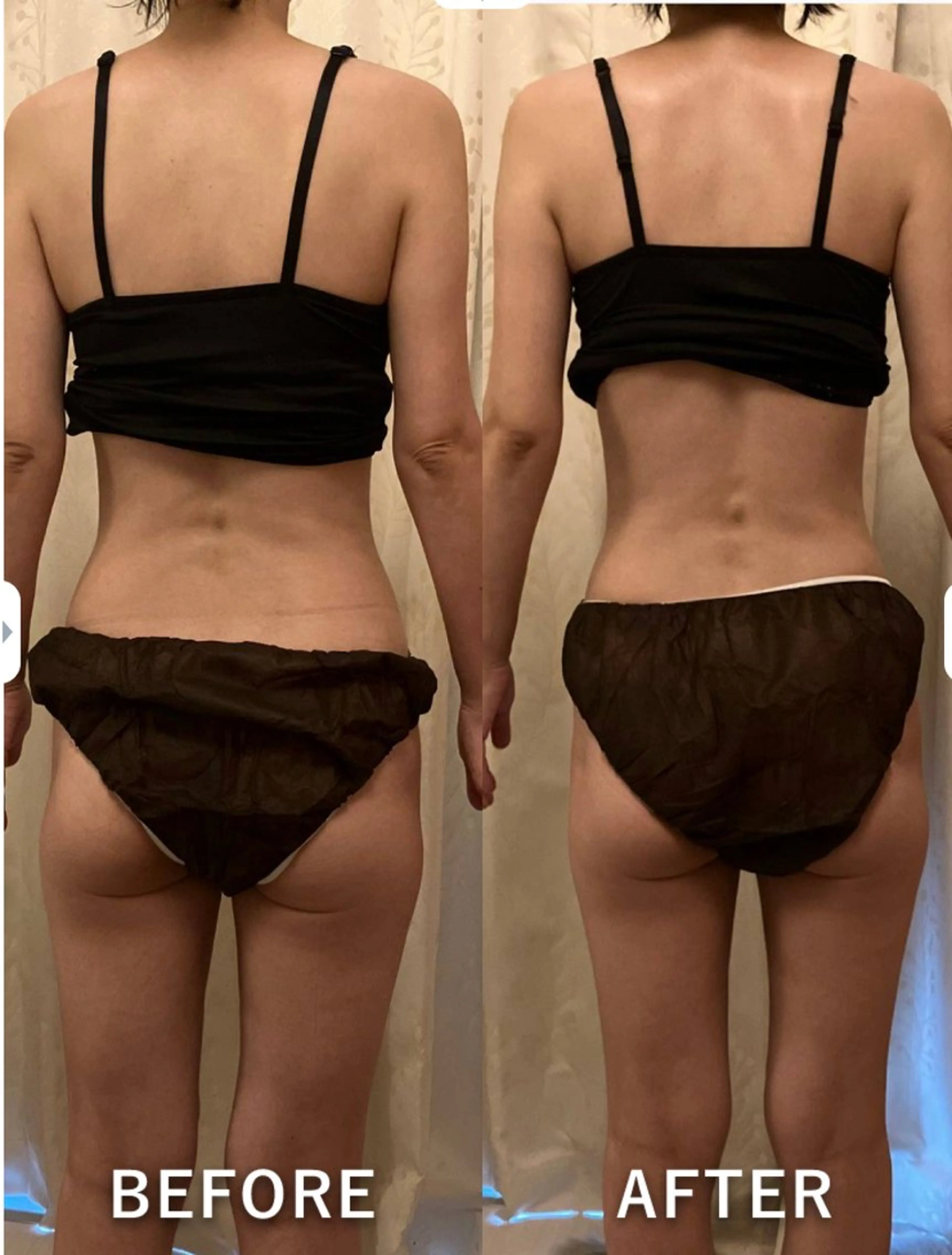 θTHETAメソッド　シエスタ所属・siesta バストアップ痩身のエステ・リラクイメージ