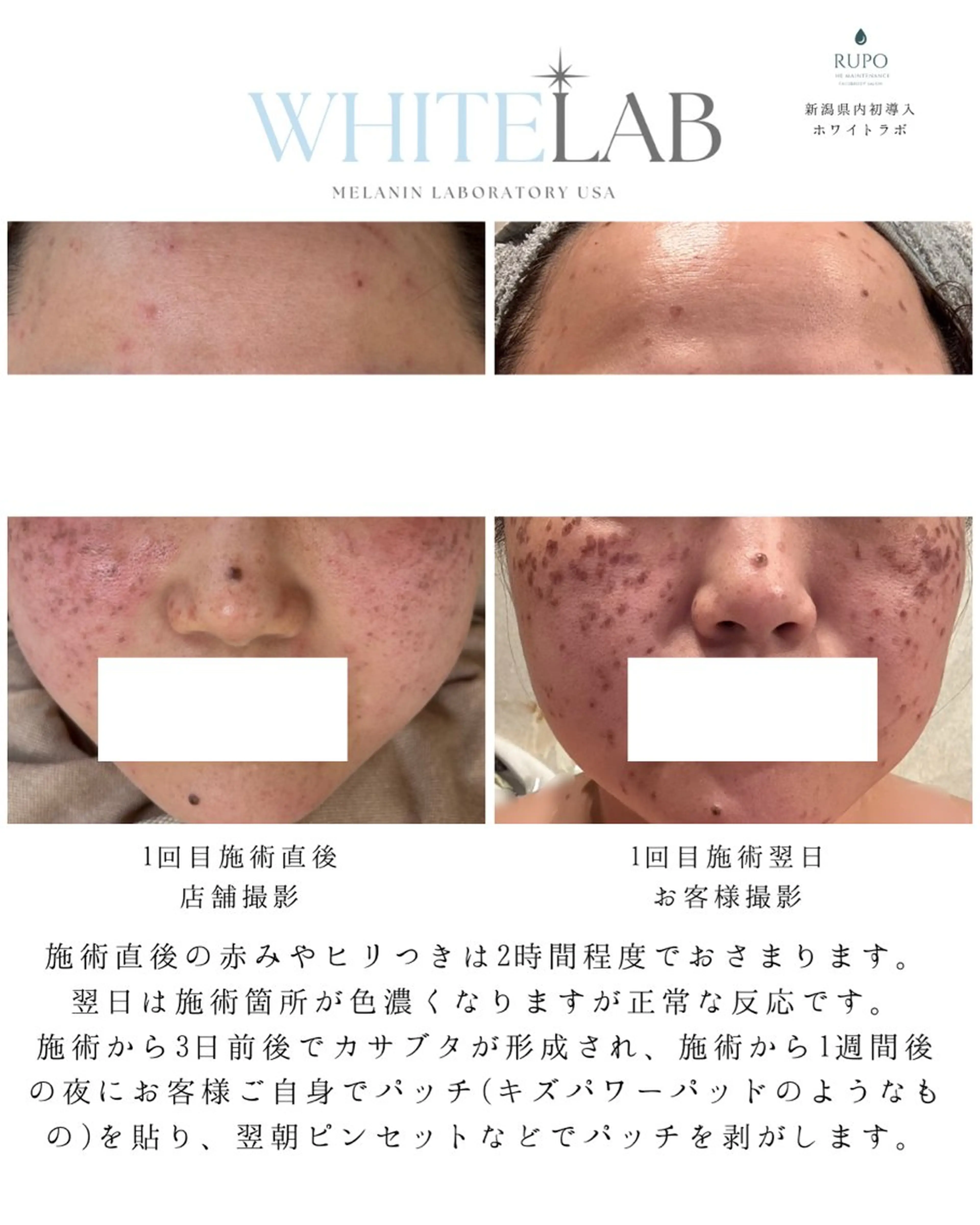 エステ RUPO THE MAINTENANCE新潟店【ローマピンク公式認定店/ララピール正規店/骨格小顔】所属・オーナー Nanjoのエステ・リラクイメージ