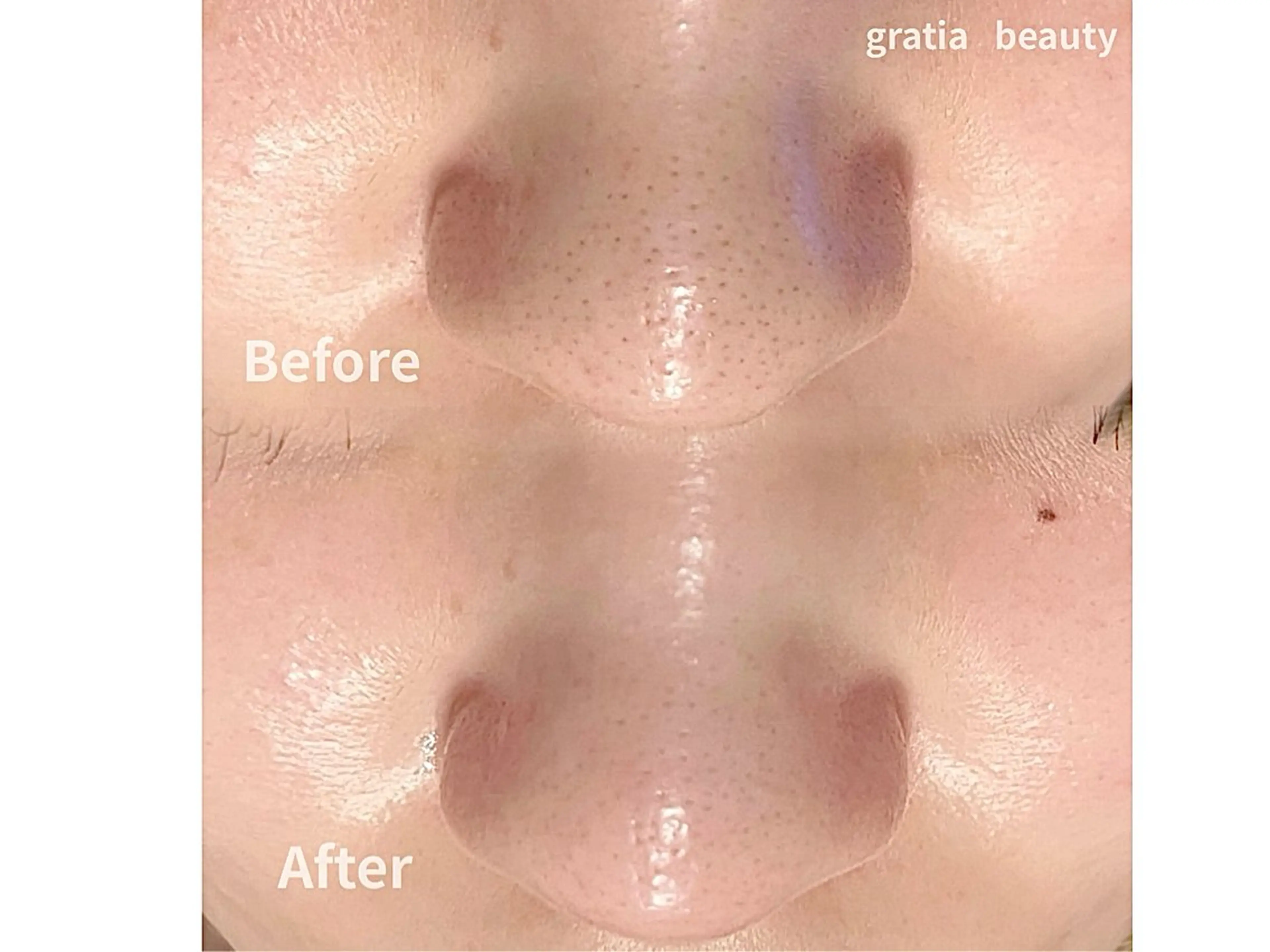 エステ gratia  eyelash&nail所属・gratia salonのその他イメージ