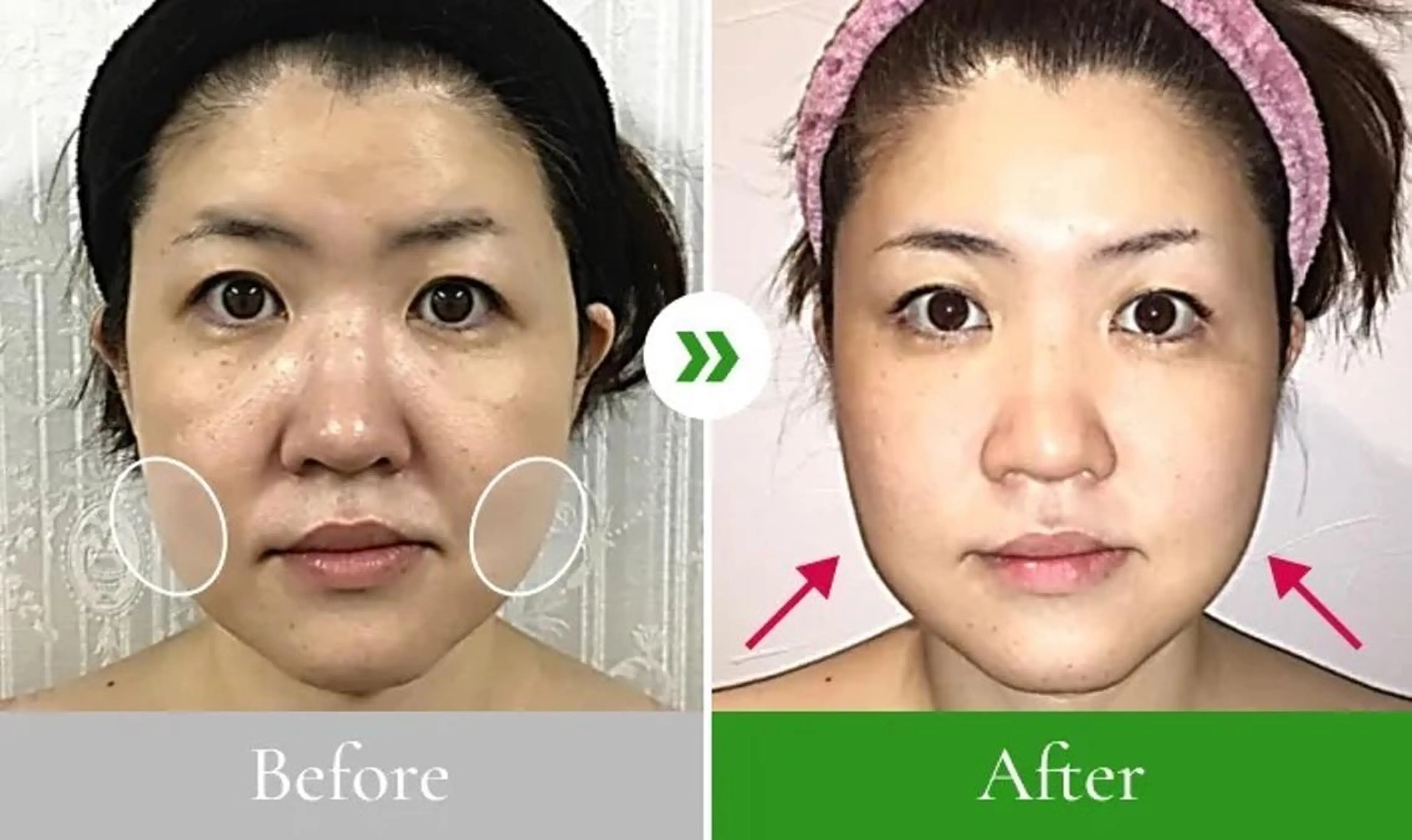 小顔整体研究所 KSラボ川崎店内田のエステ・リラクイメージ