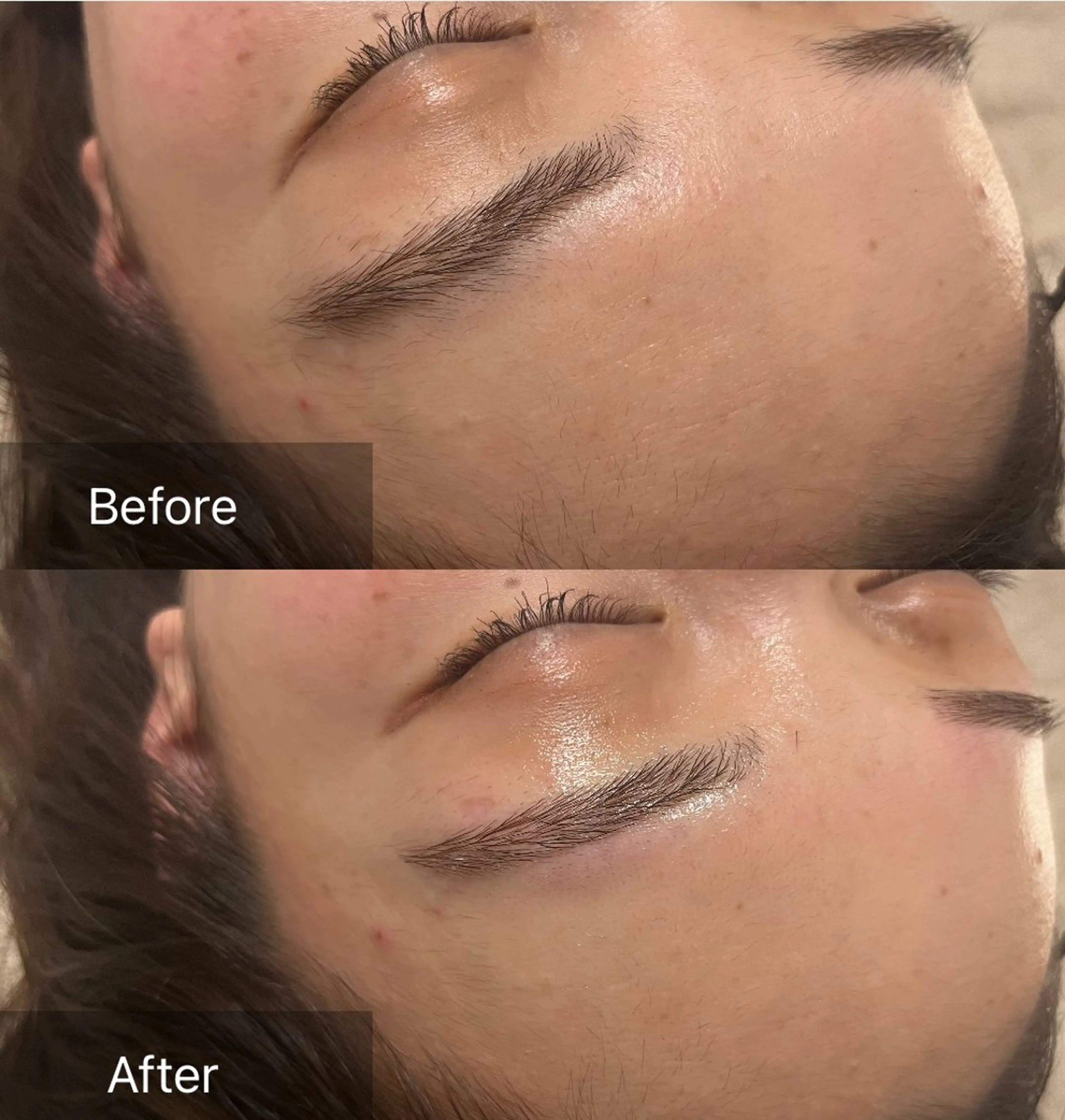 アイブロウ for woman所属・森 美優のエステ・リラクイメージ