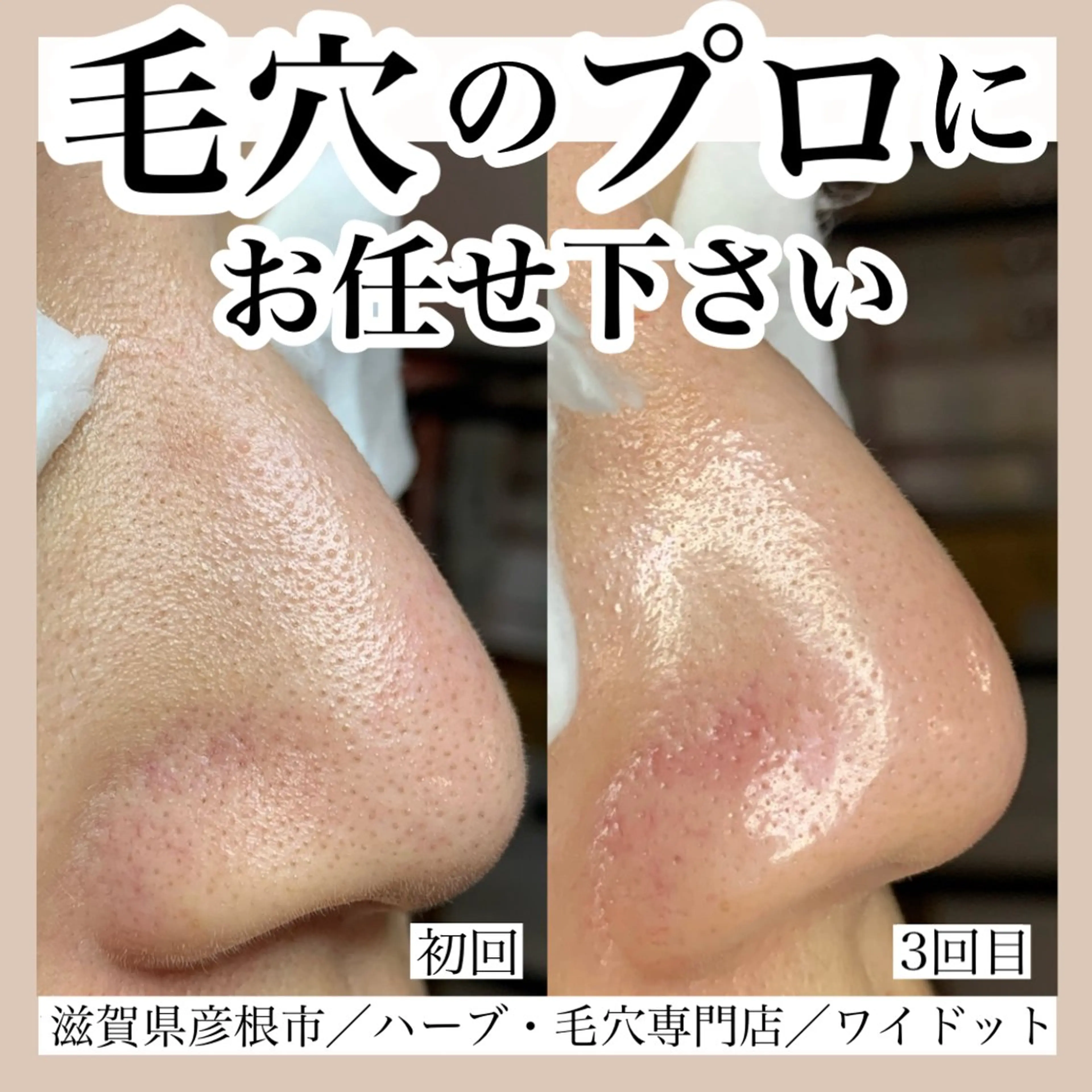 エステ Ydot. 池内 友架のエステ・リラクイメージ