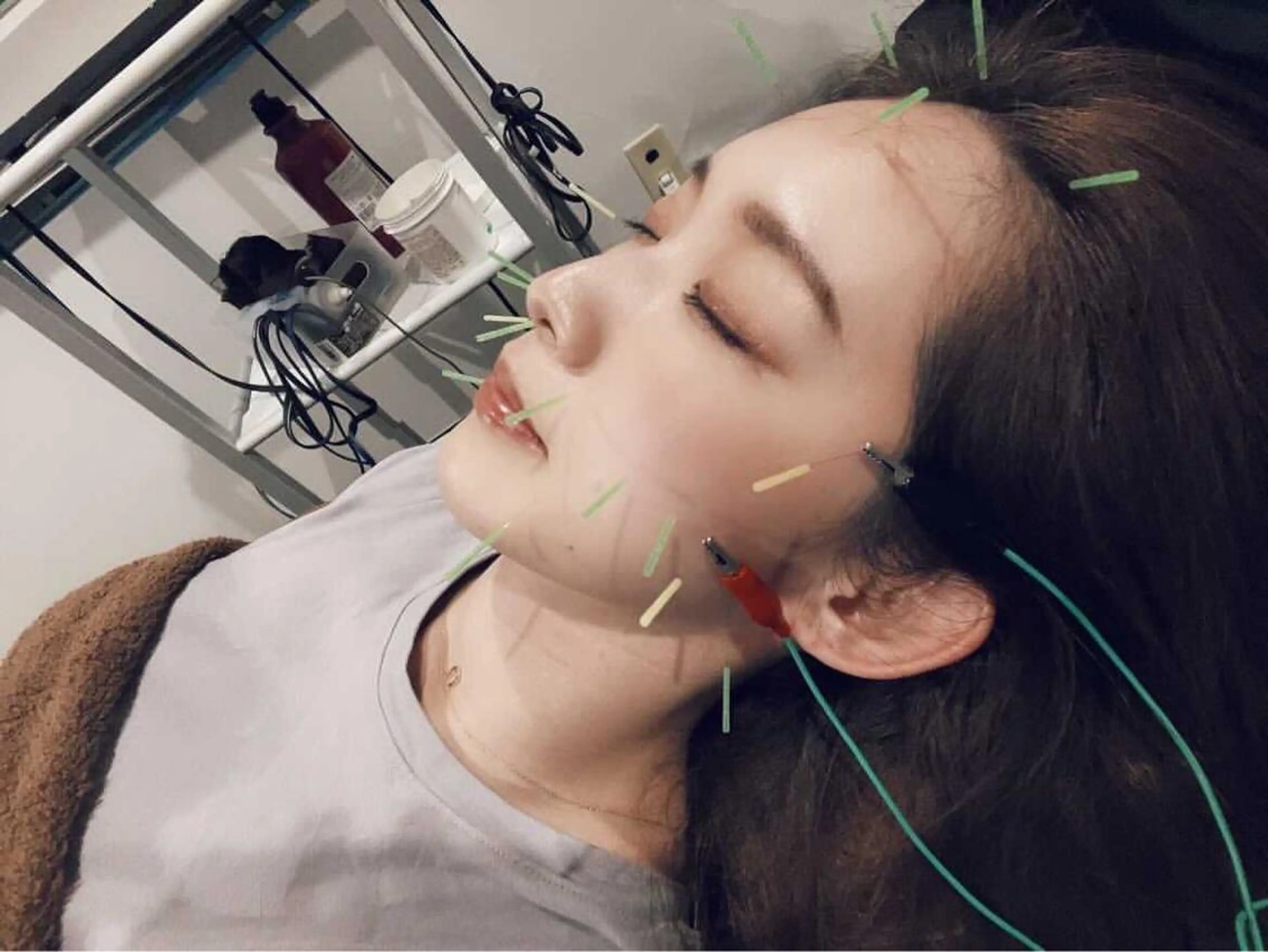 ⭐️美容鍼、60分マッサージ(整体)セット⭐️の写真