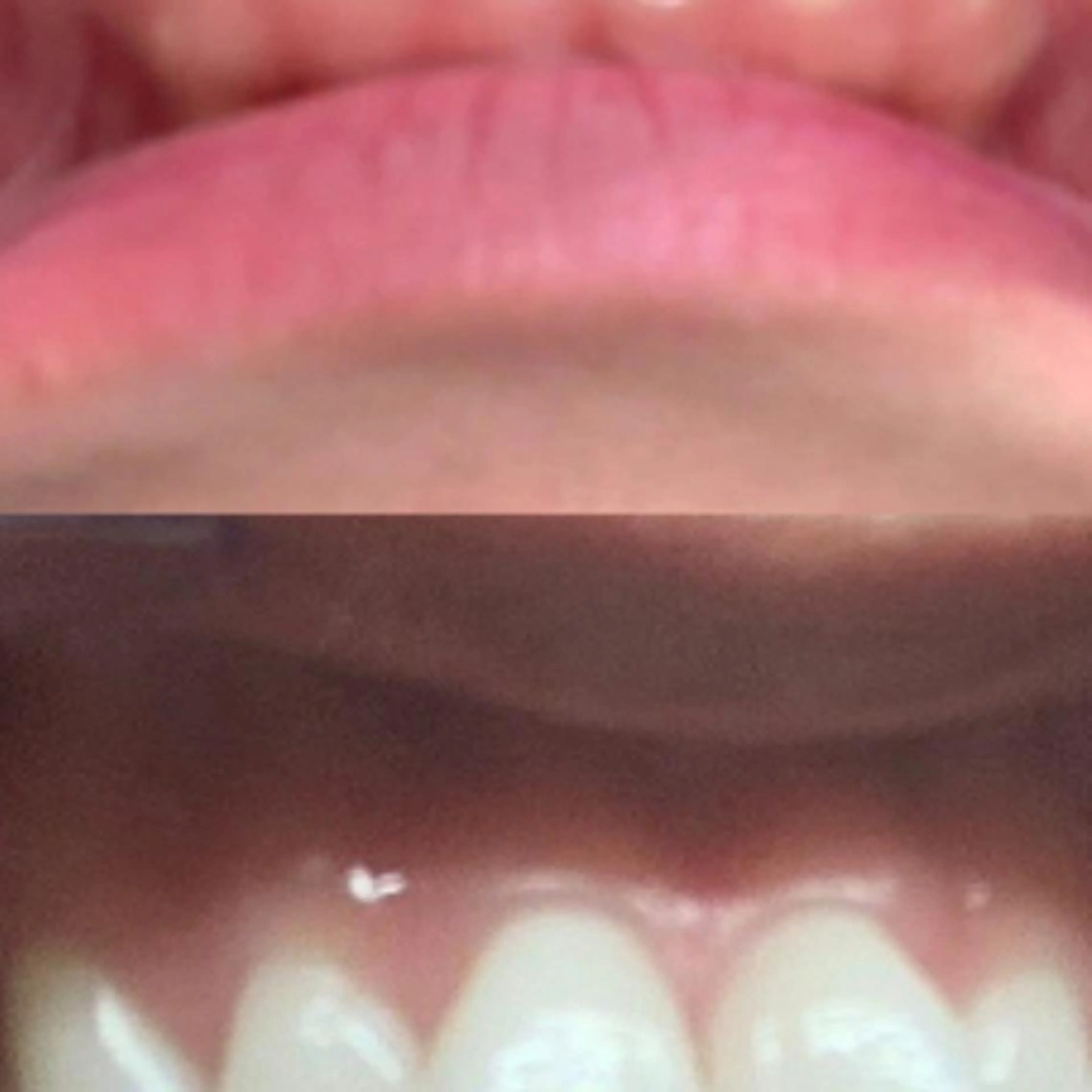 その他 ライトケアサロン 渋谷店② 渡邊のその他イメージ