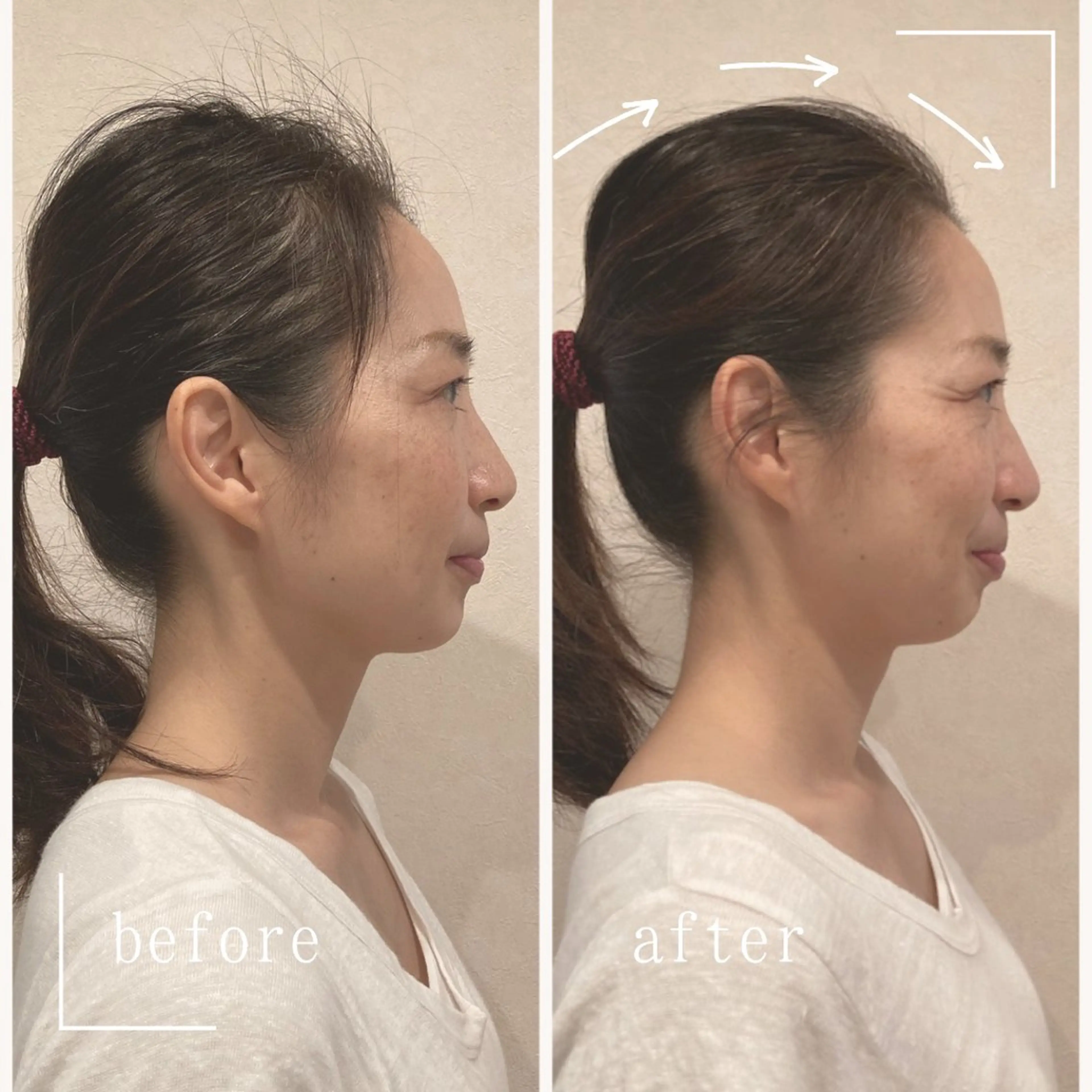 エステ リラク 小顔×肌質改善サロン soin〔ソワン〕のエステ・リラクイメージ