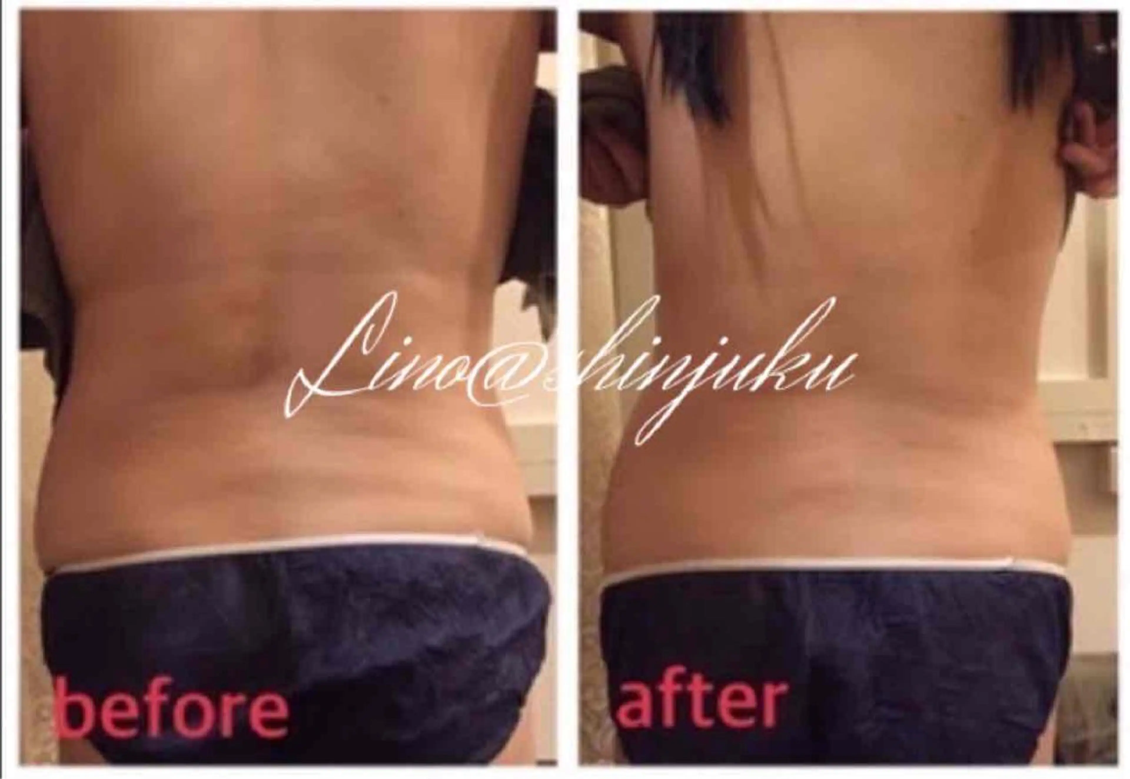 痩身·ハイパーナイフ ヘッドスパ·アロマのエステ・リラクイメージ