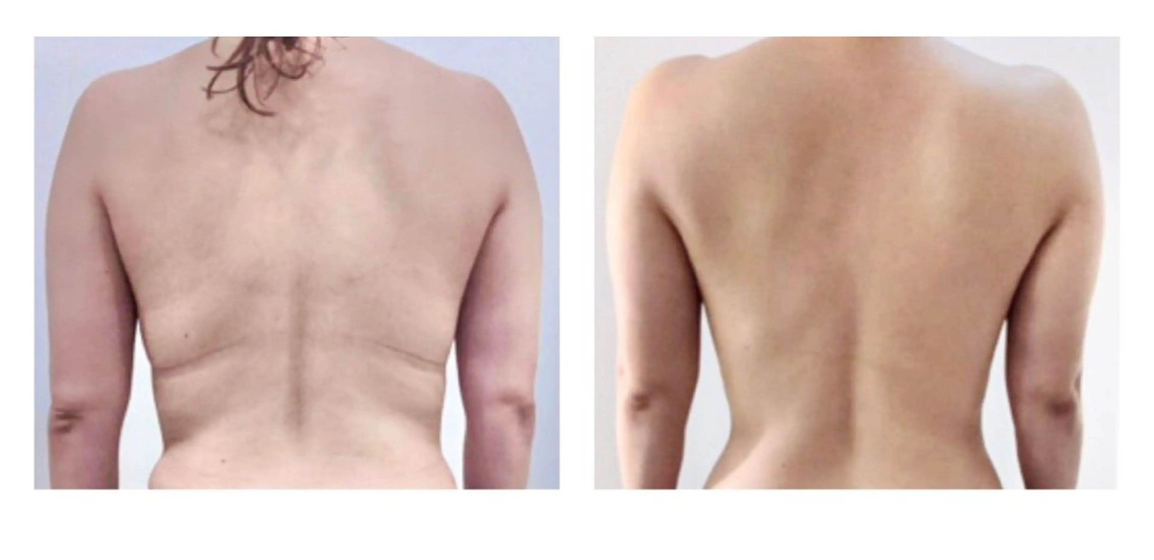 8 caratのエステ・リラクイメージ