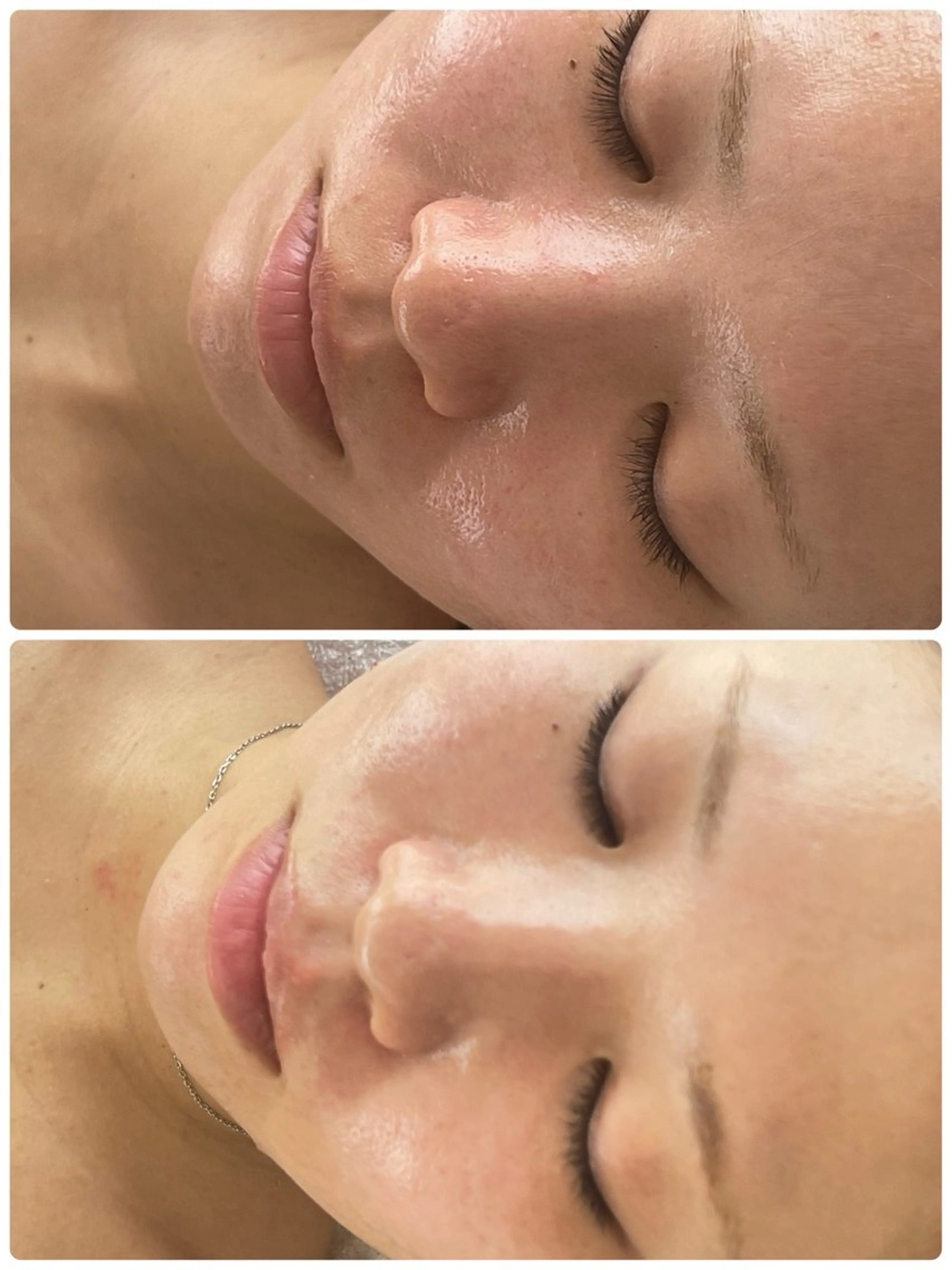 エステ ohana所属・河合 菜月のエステ・リラクイメージ