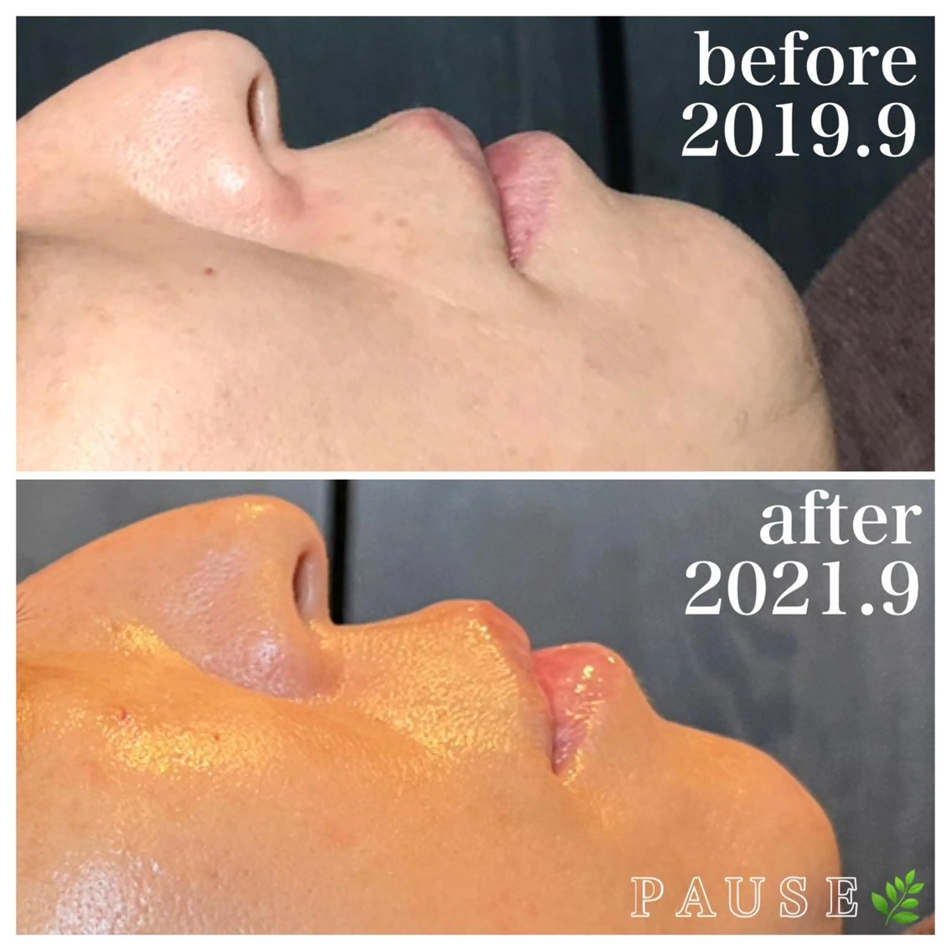 エステ 浜野 恵美のエステ・リラクイメージ